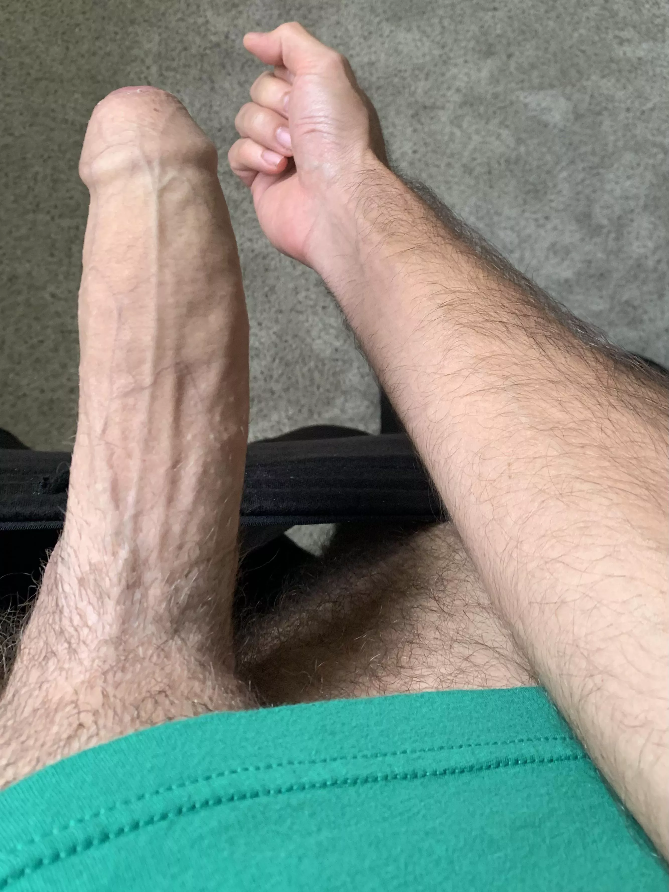 Compared to my other leg ðŸ¤­