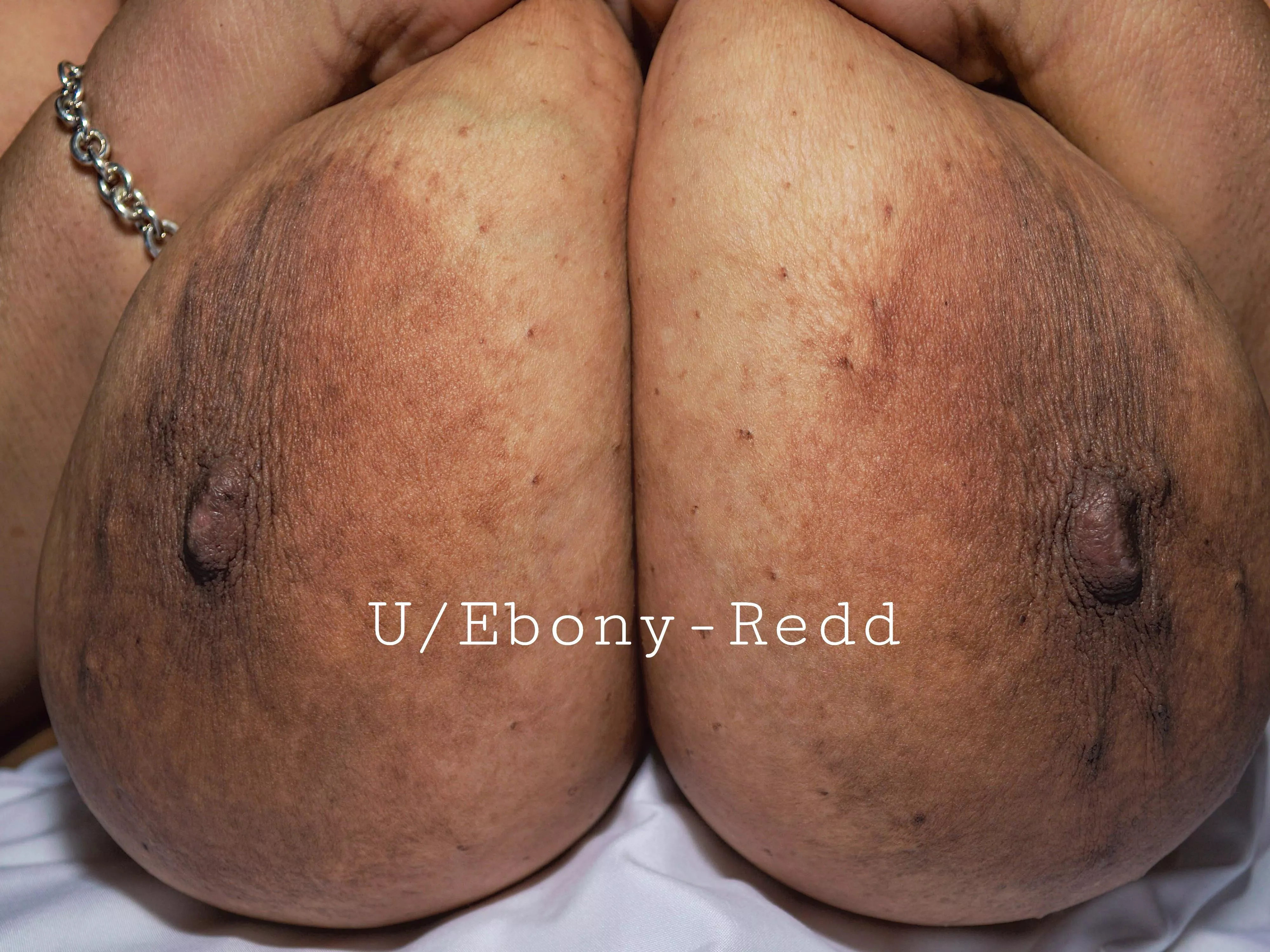 Do my brown and bumpy areolas belong here?