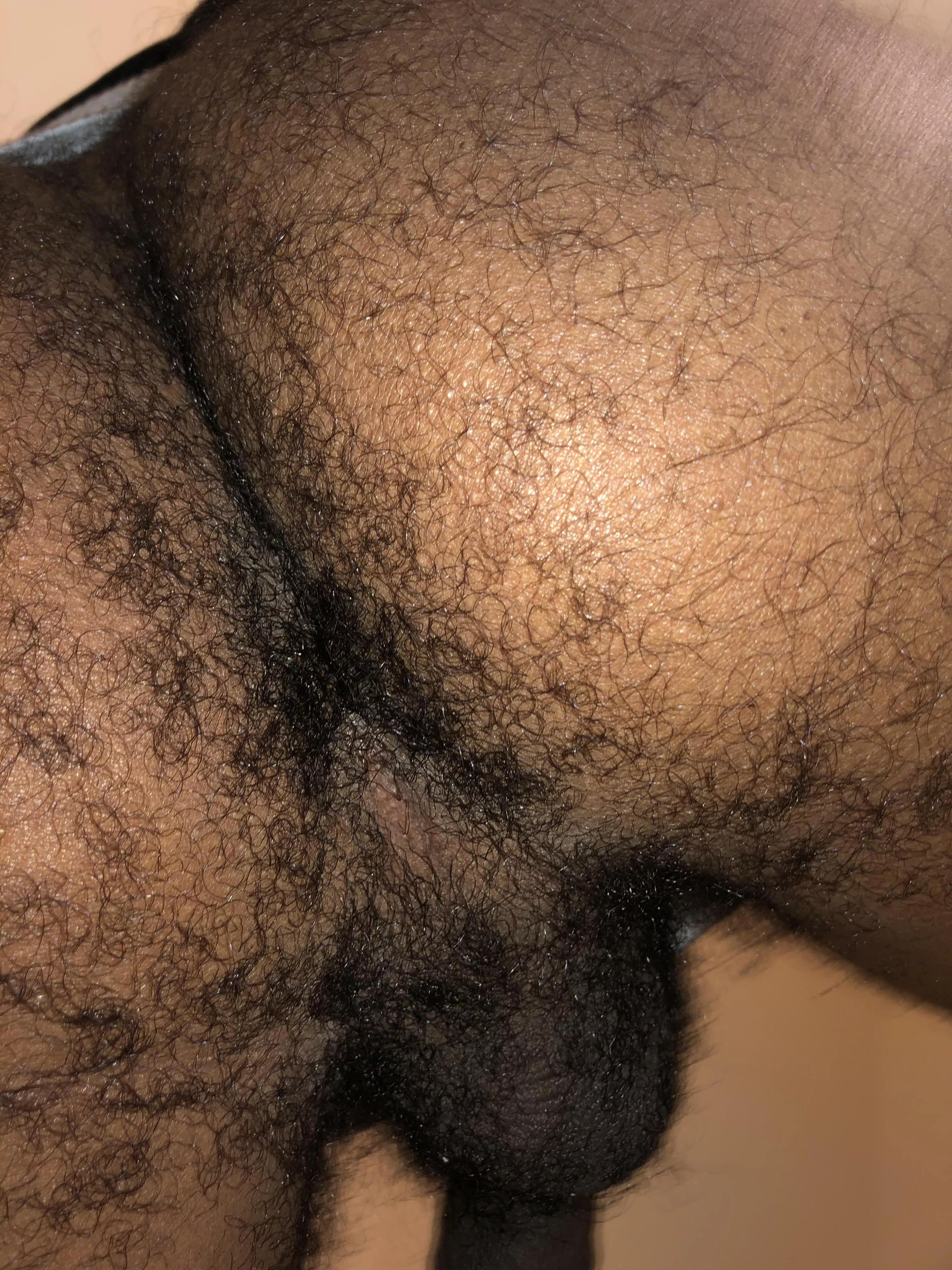 Do you like em hairy and clean? 🌸