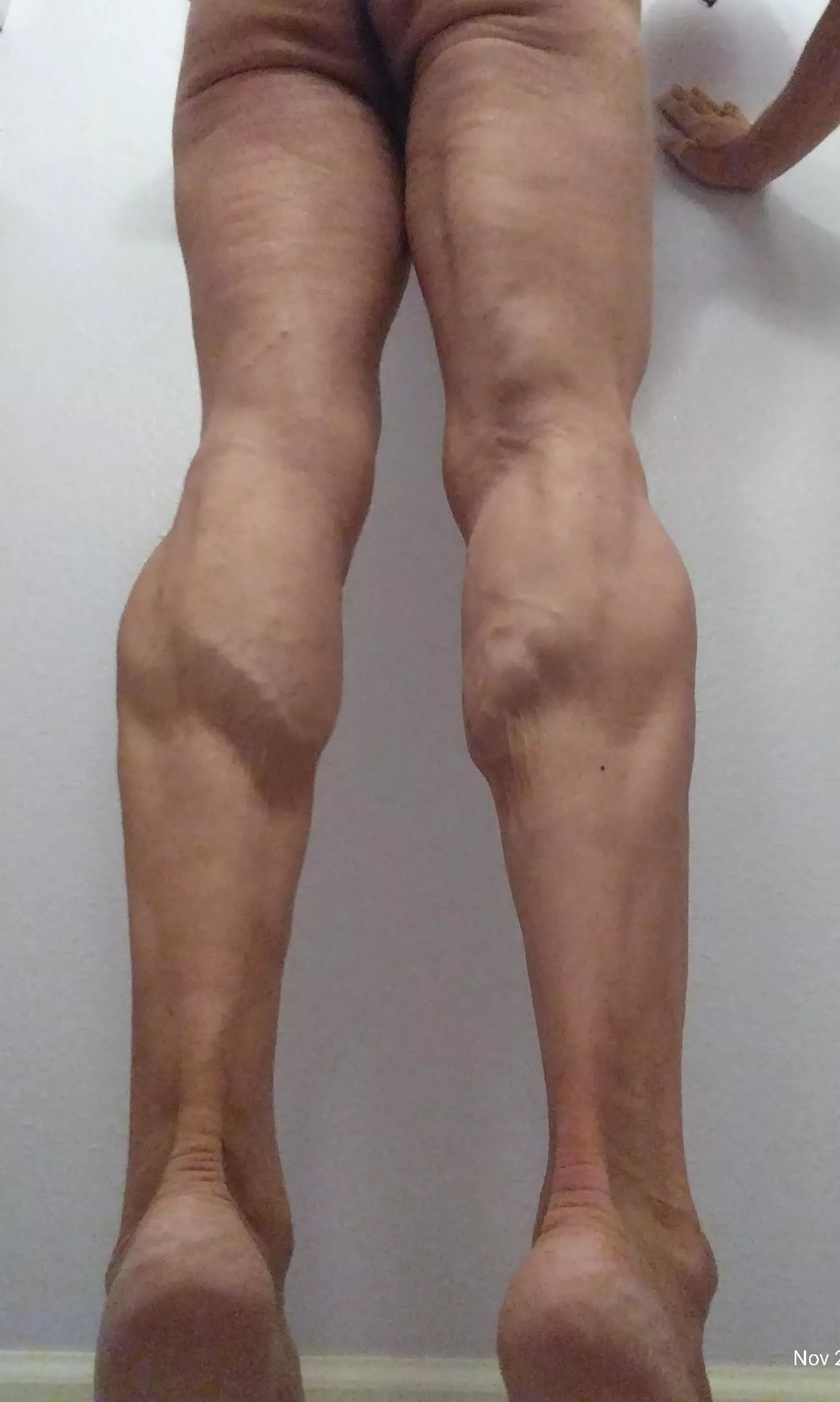 Don't skip leg day (m)(65)