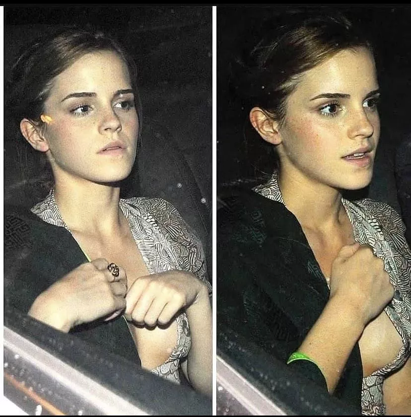 Emma Watson side boob