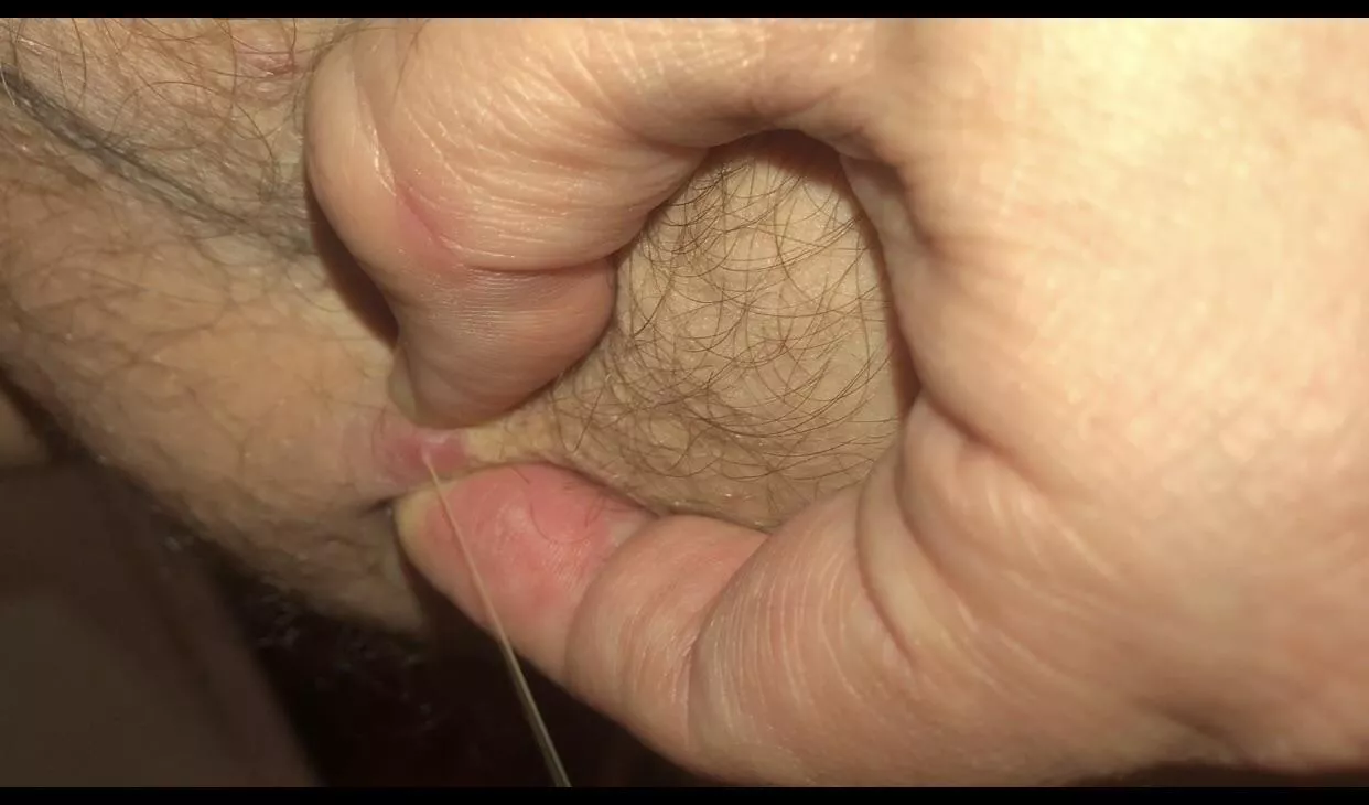 Epic pimple found on my inner thigh yesterday. This is a Screenshot from a longer video, let me know if you guys want me to repost it. Projectile much? Forbidden milk.