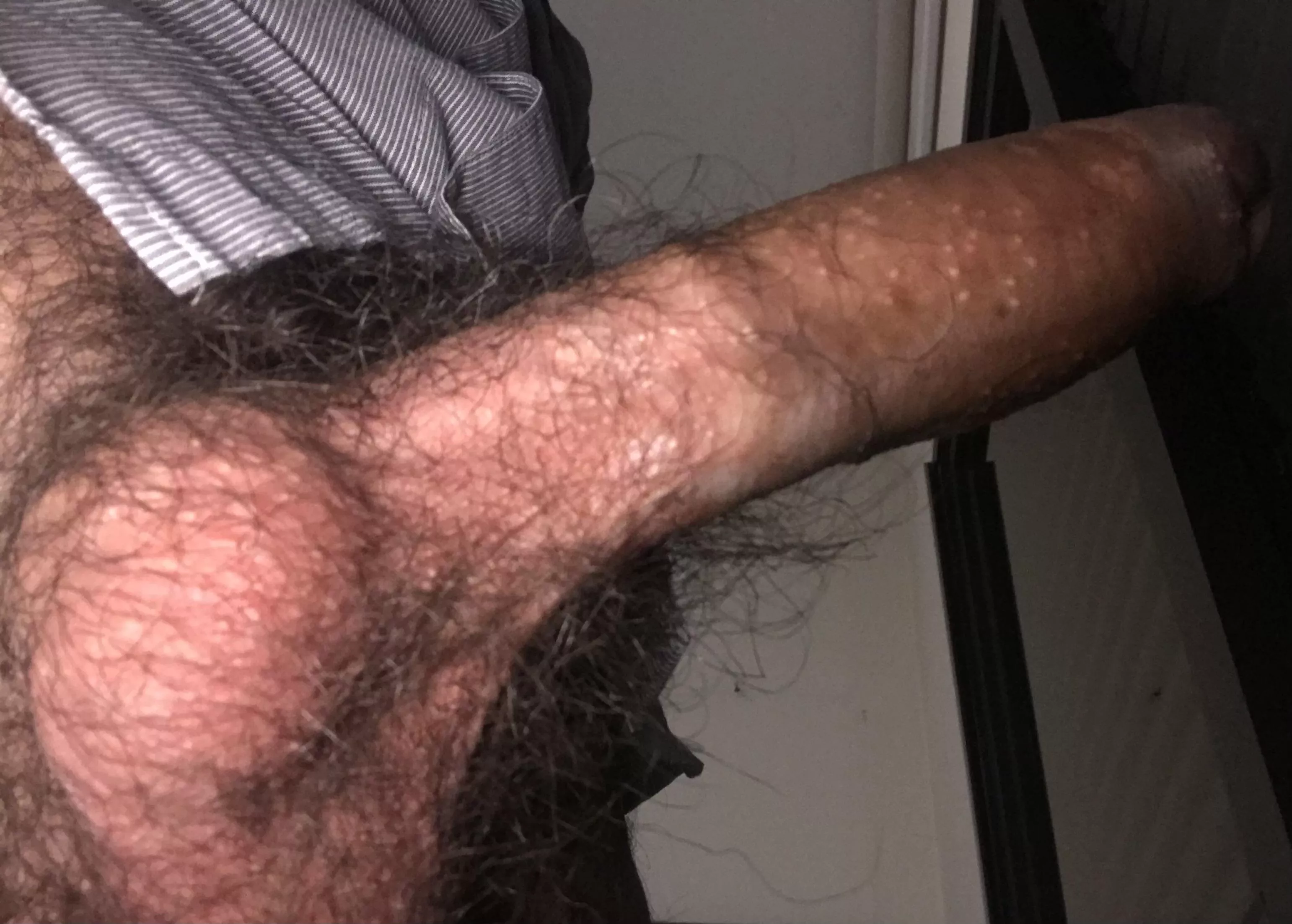 Erect & hairy!