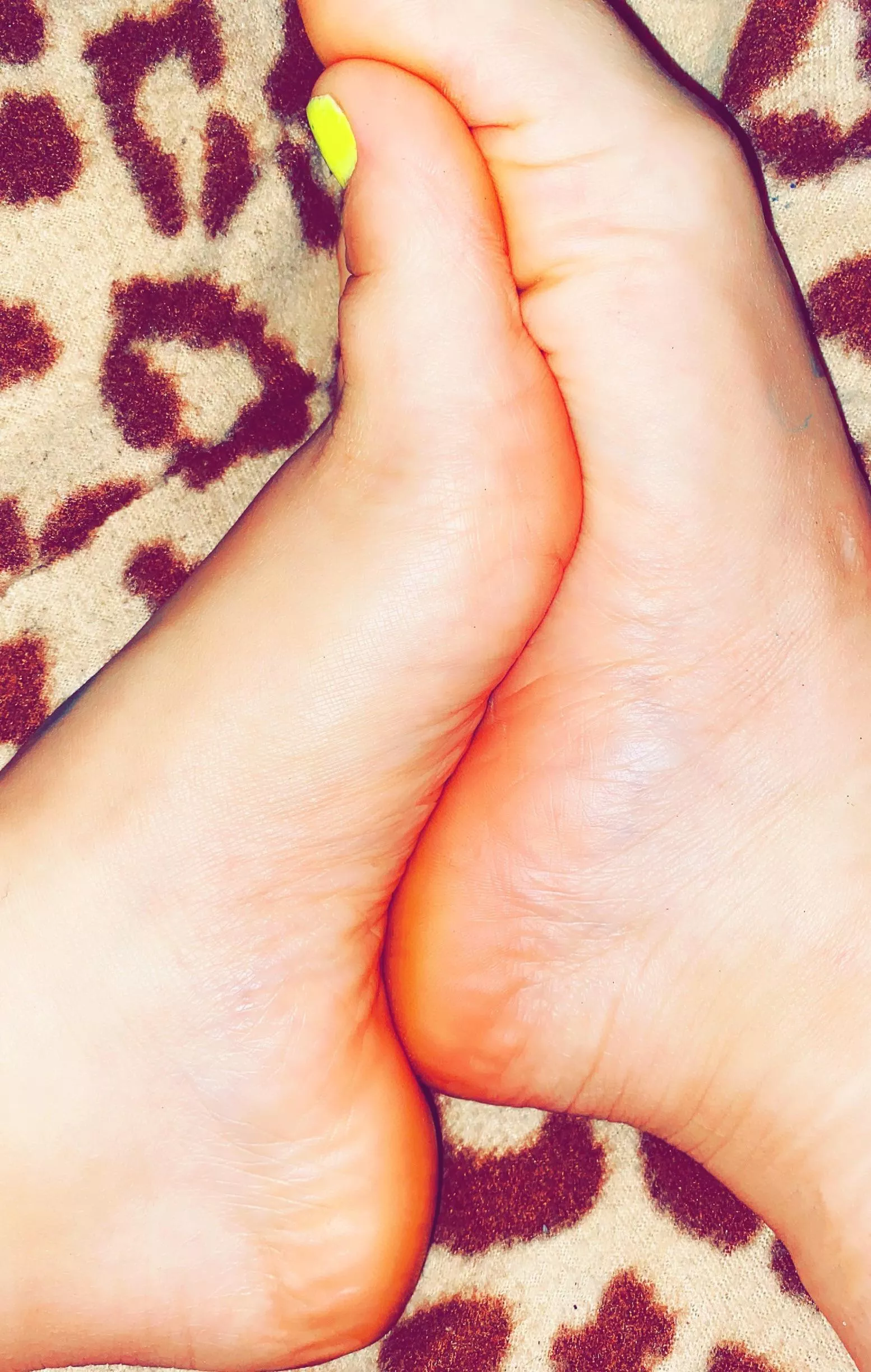 Feet needs attention ðŸ˜ŠðŸ˜ˆ