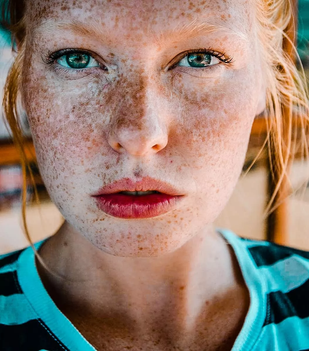 Freckles ♥️