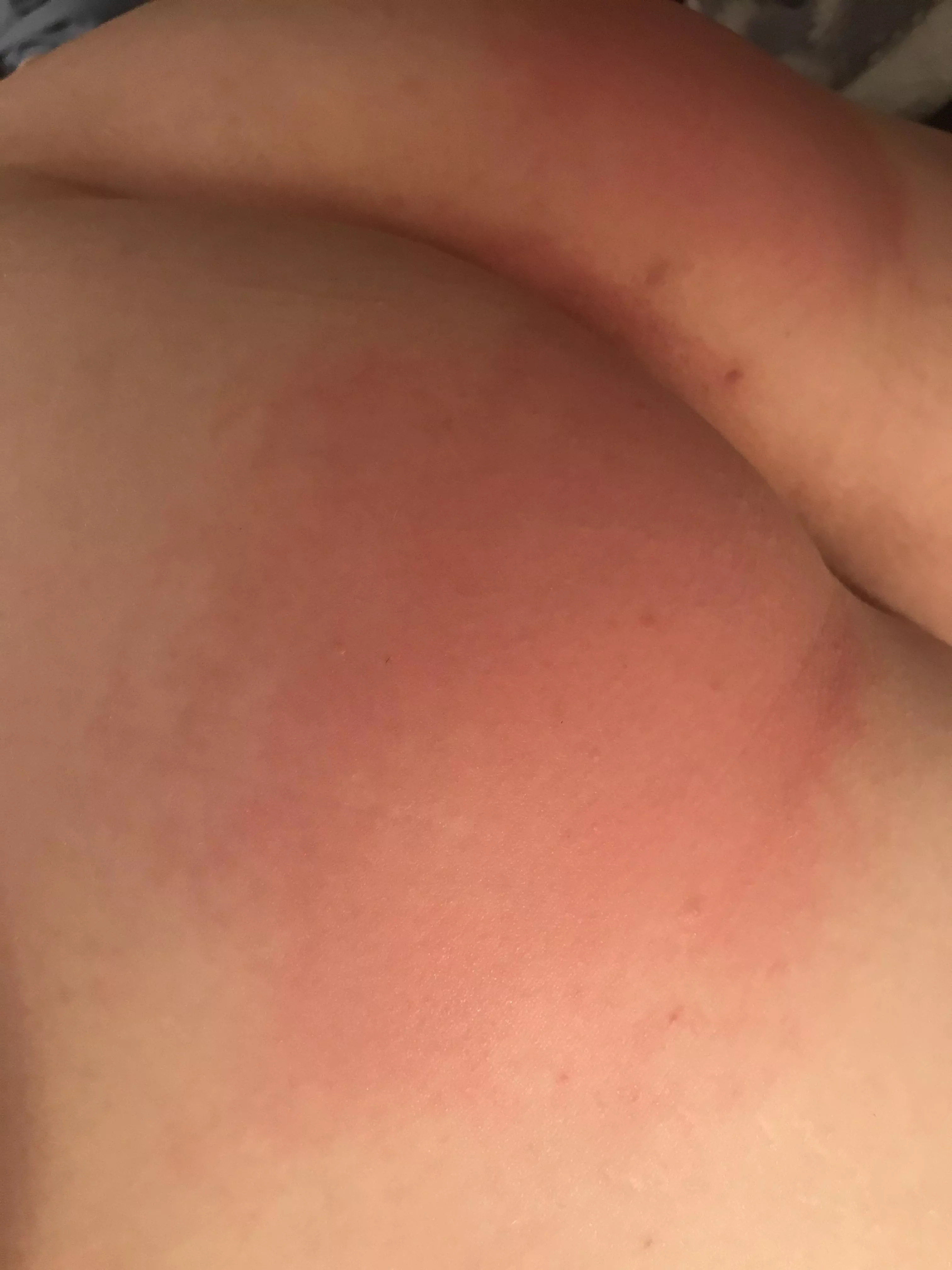 Got punished again last night for cumming without permission oopsies!!