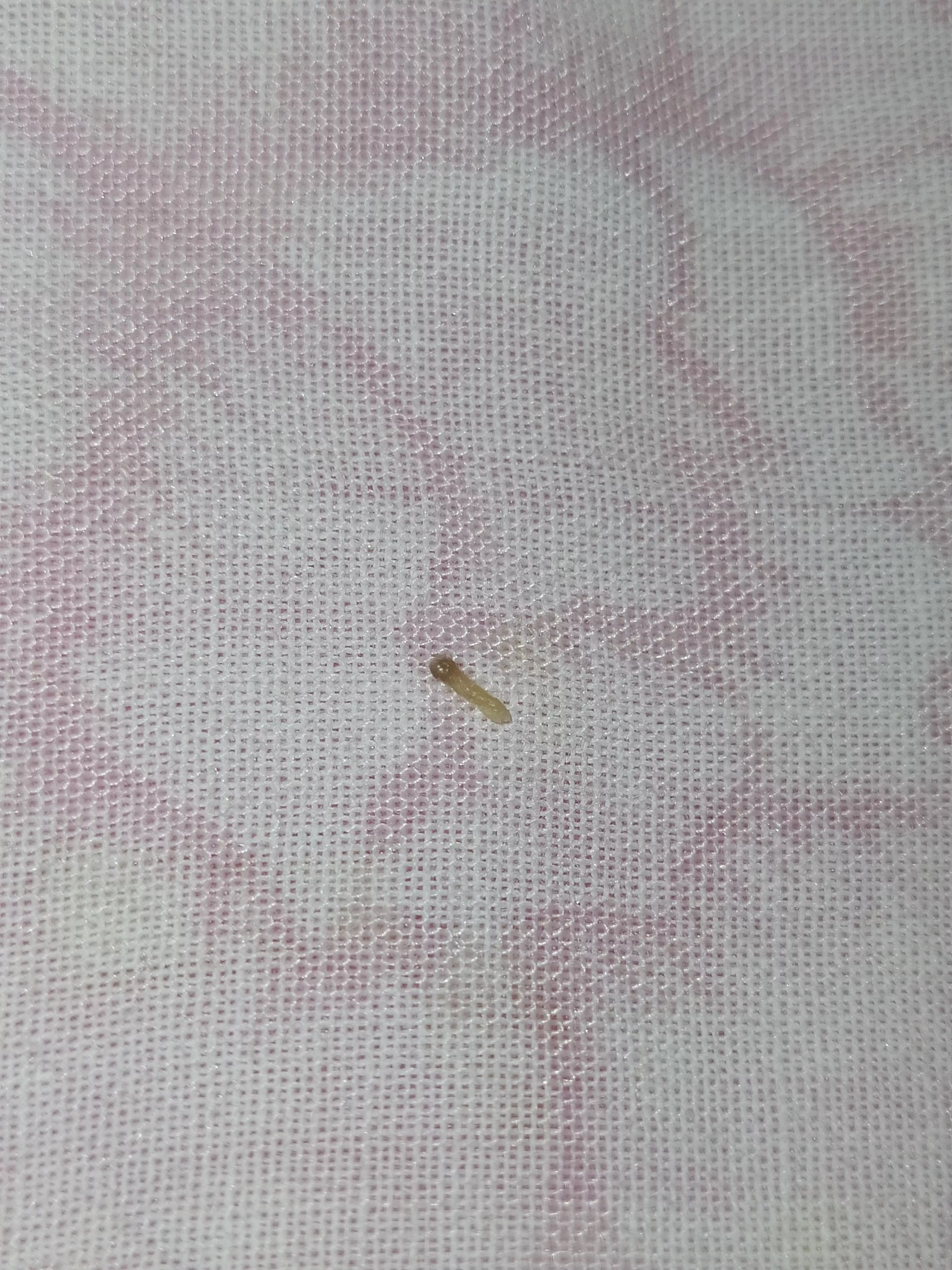 Got this out of my apparently closed lobe piercing