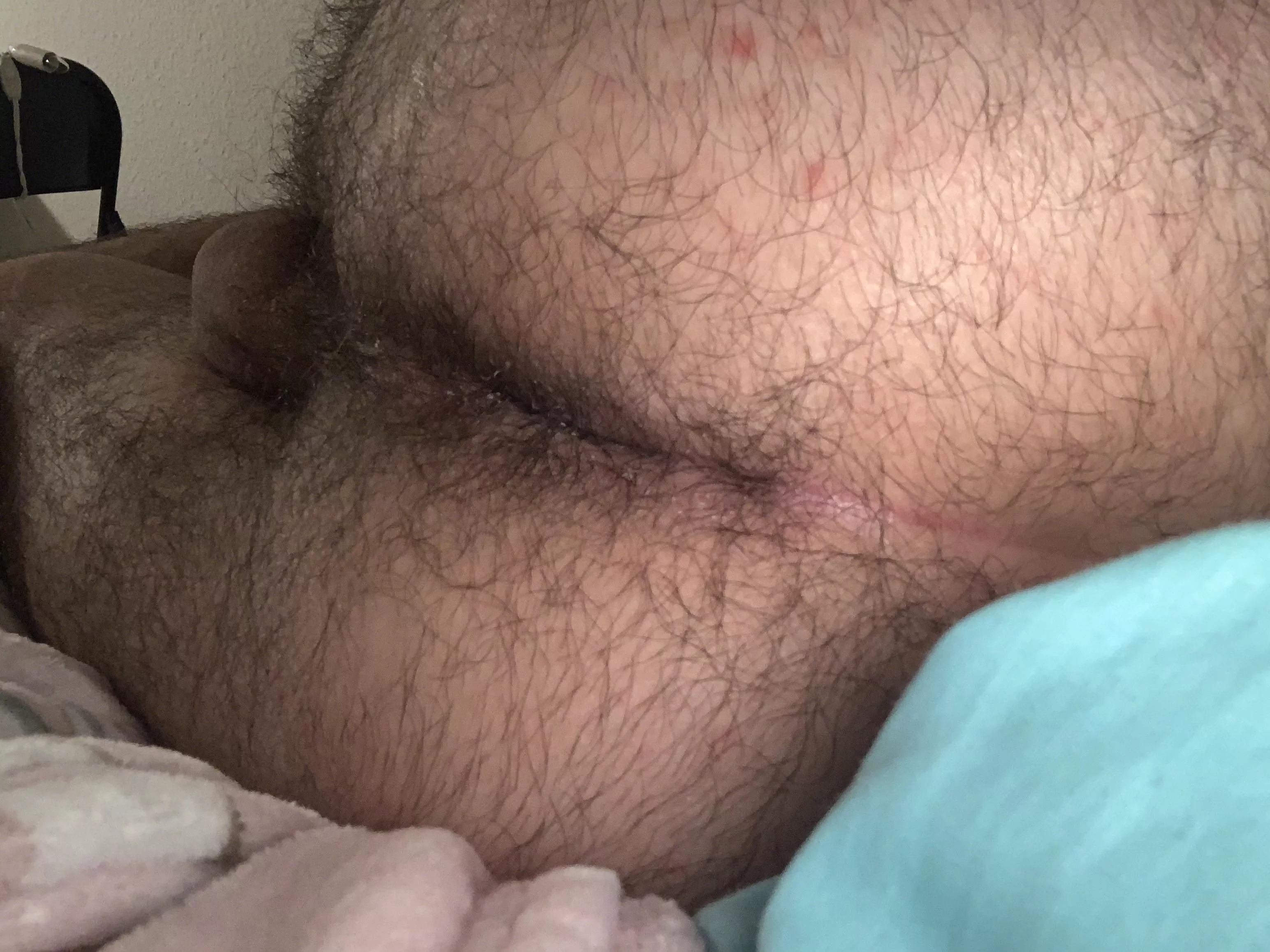 Hairy boy cunt