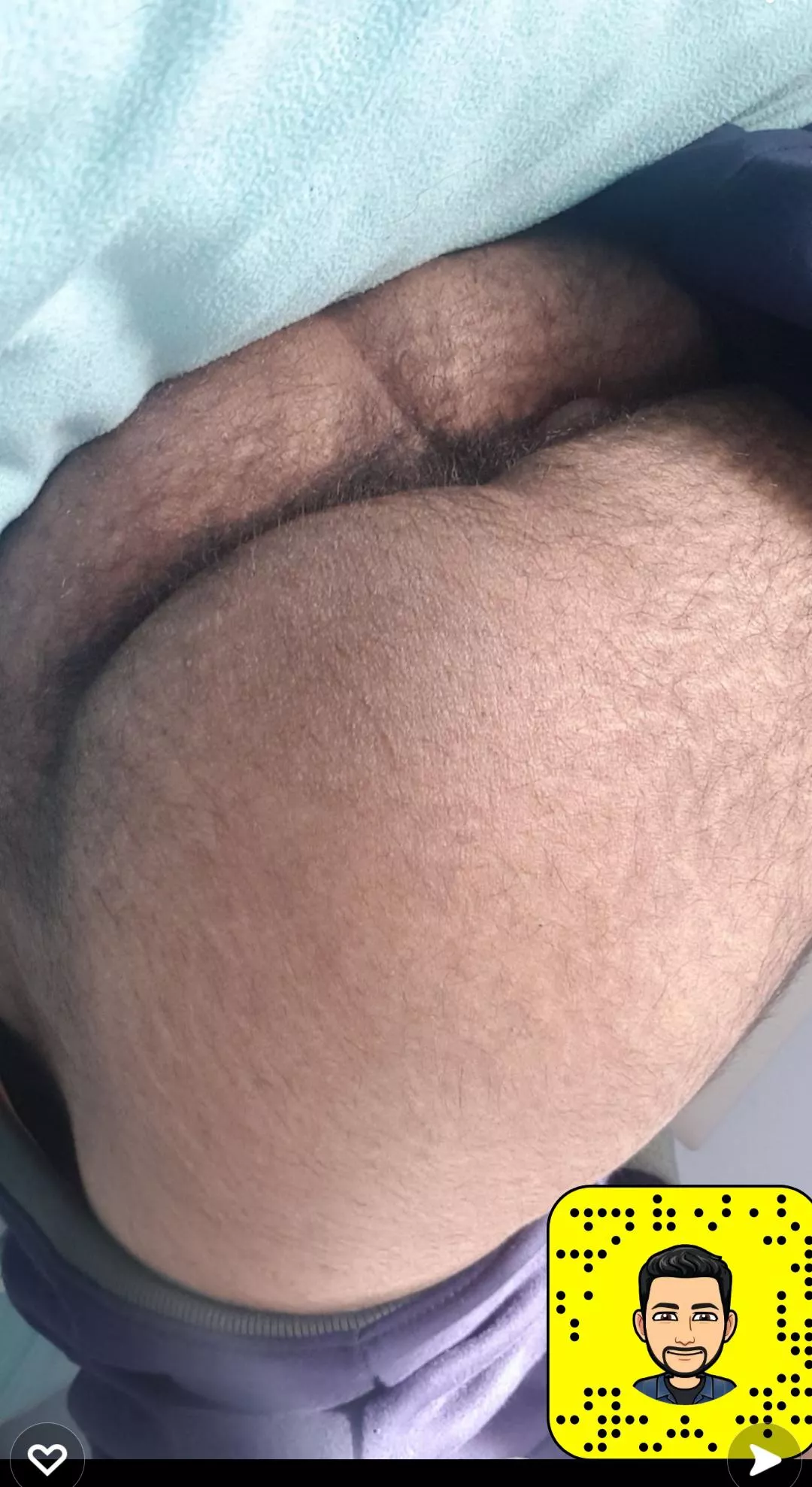 Hairy crack