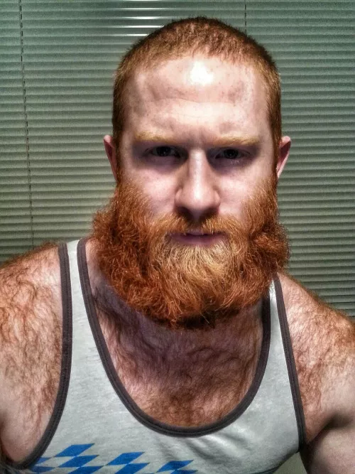 Hairy Ginger