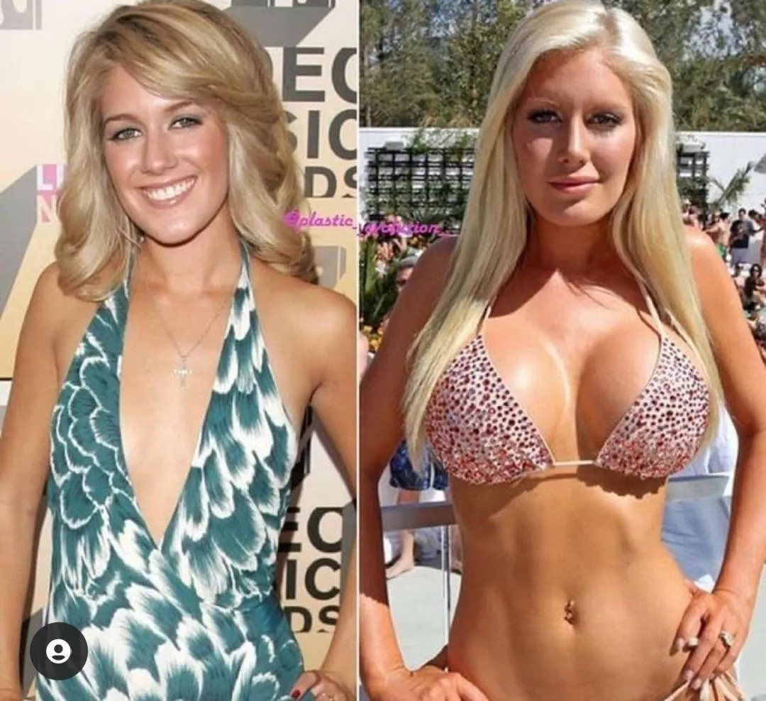 Heidi Montag