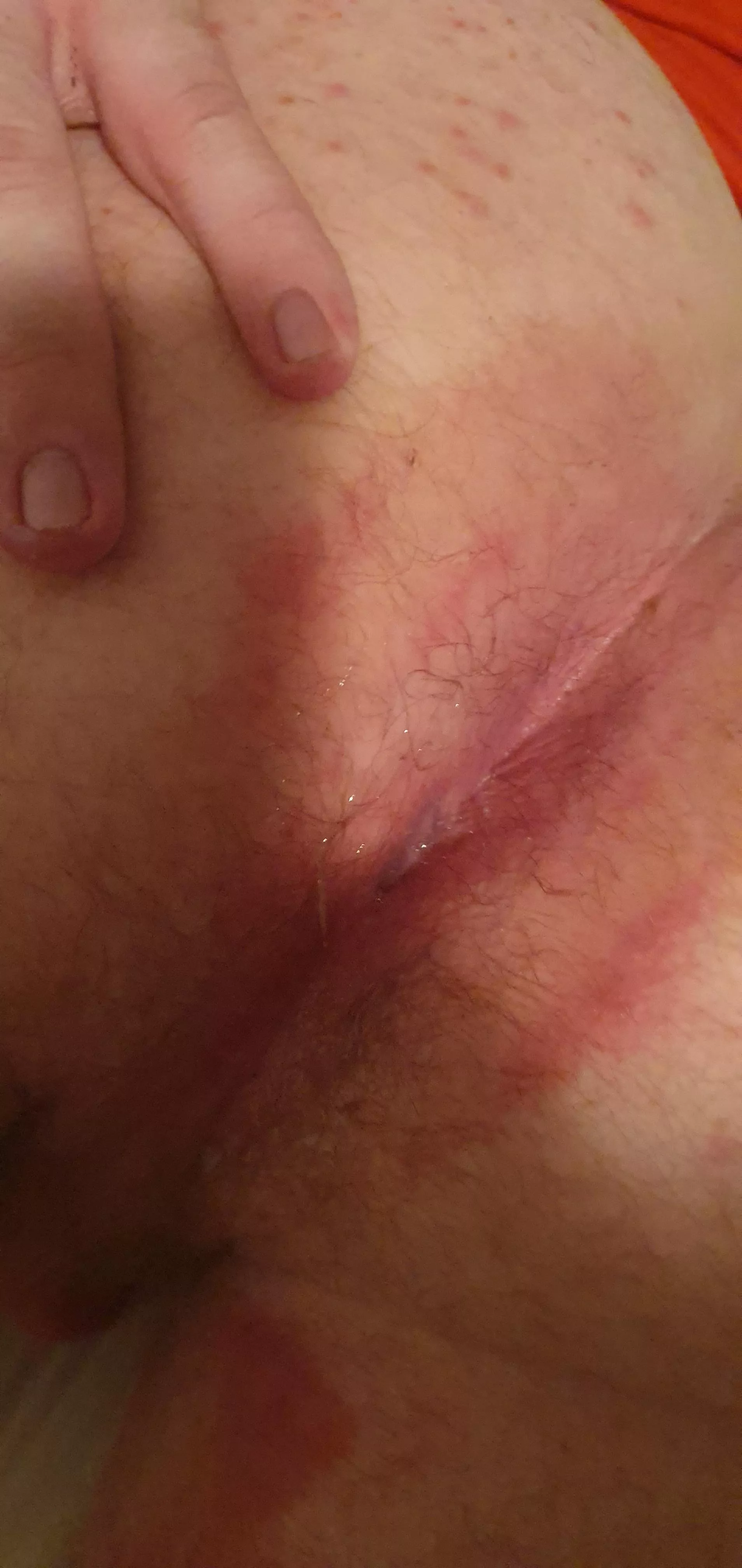 horny hole bred, 20m