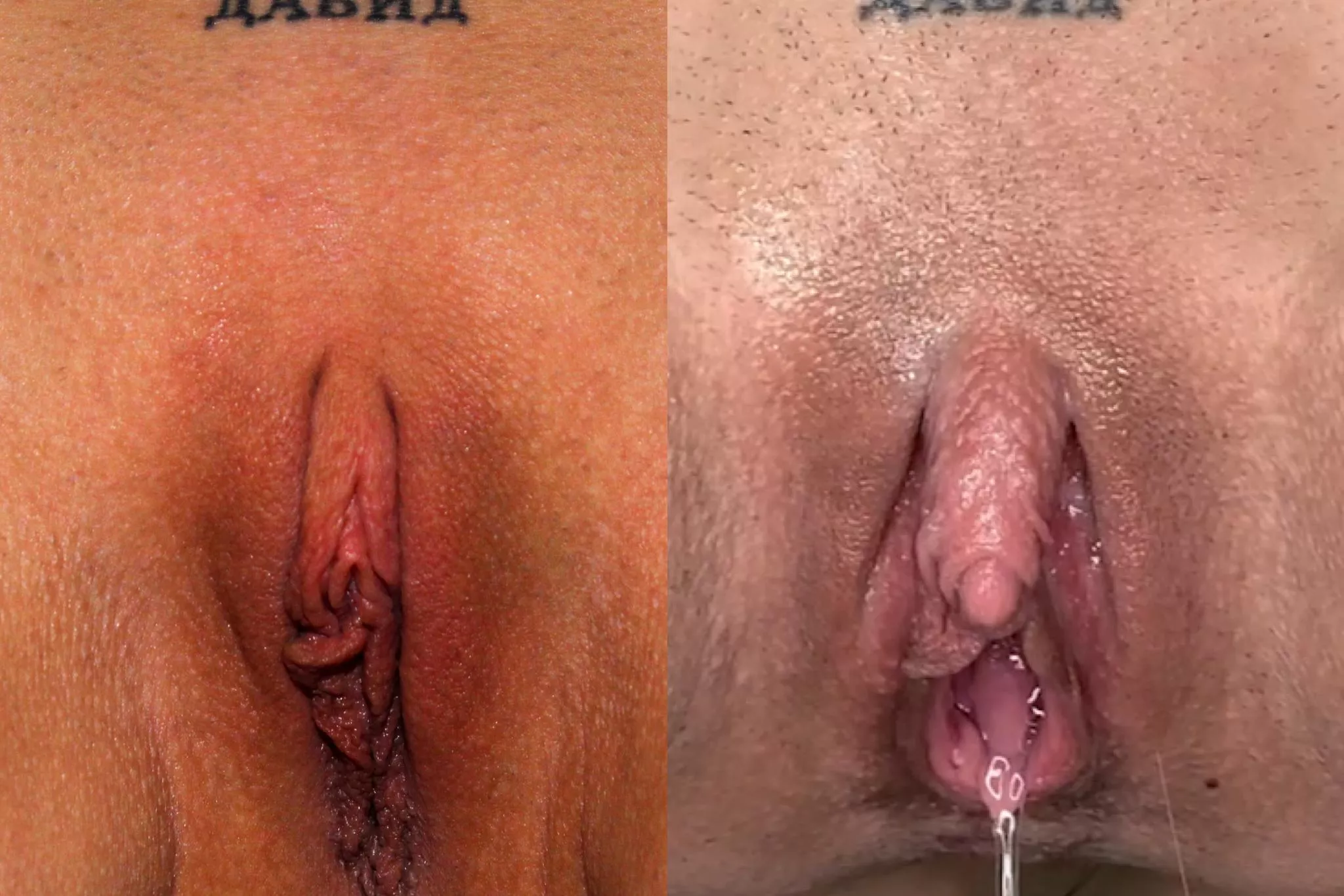 I always love sharing before & after pics of my big clit enlargement. Look how far I’ve cum! 🤤😈