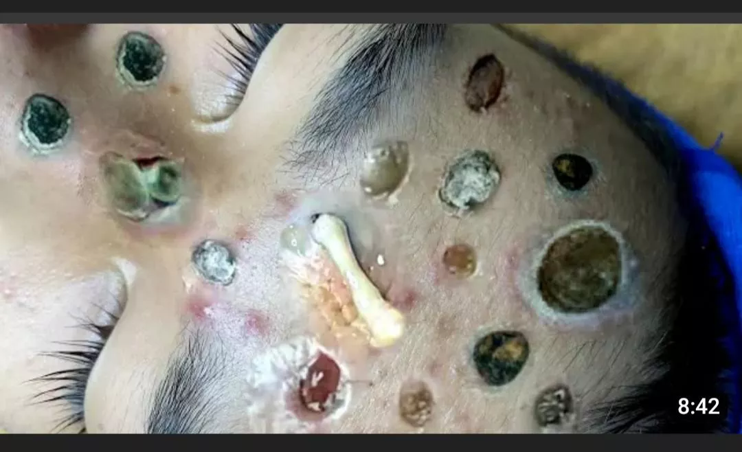 I can still see some skin without a ridiculous large and badly edited blackhead/pore/pimple - far from realistic thumbnail of a YouTube video. All their thumbnails look like this