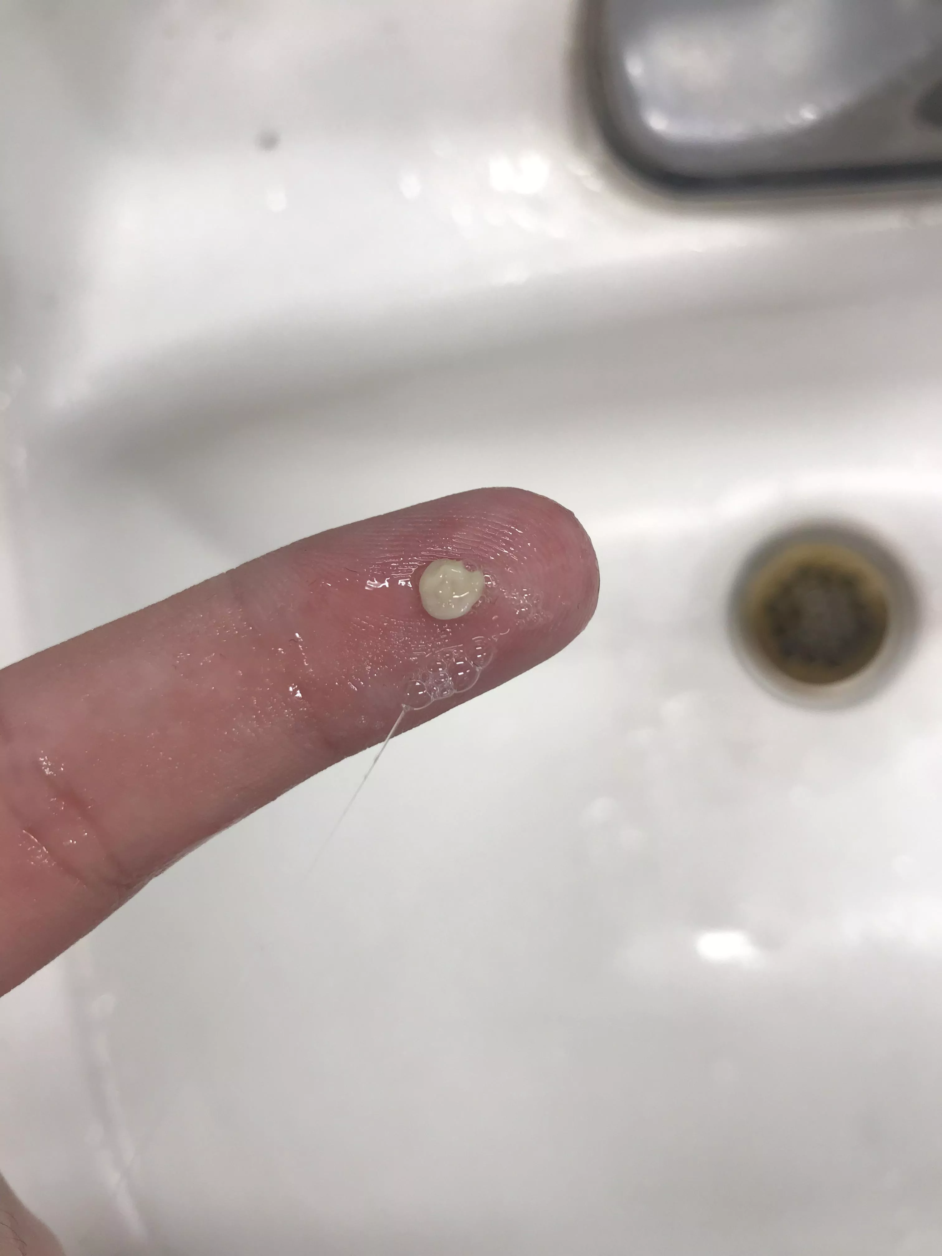 I have extremely small tonsils, to the point the ENT dr thought Iâ€™d had them removed. Combined with an overly sensitive gag reflex, Iâ€™ve never been able to remove the stones, just suffer through them. Tonight I finally got one out!