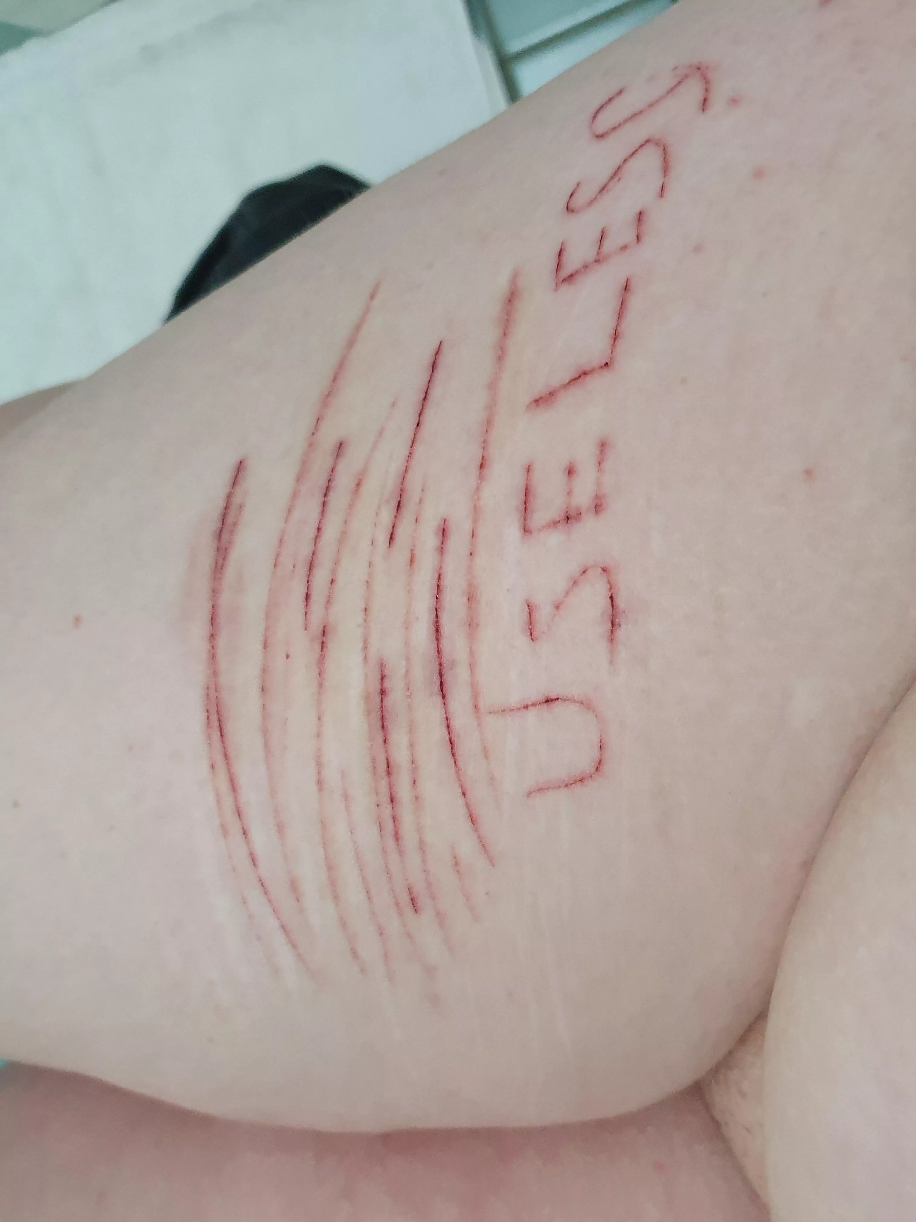 I know im your useless little whore daddy, so i carved it into my filthy piggy leg for you ehehehe