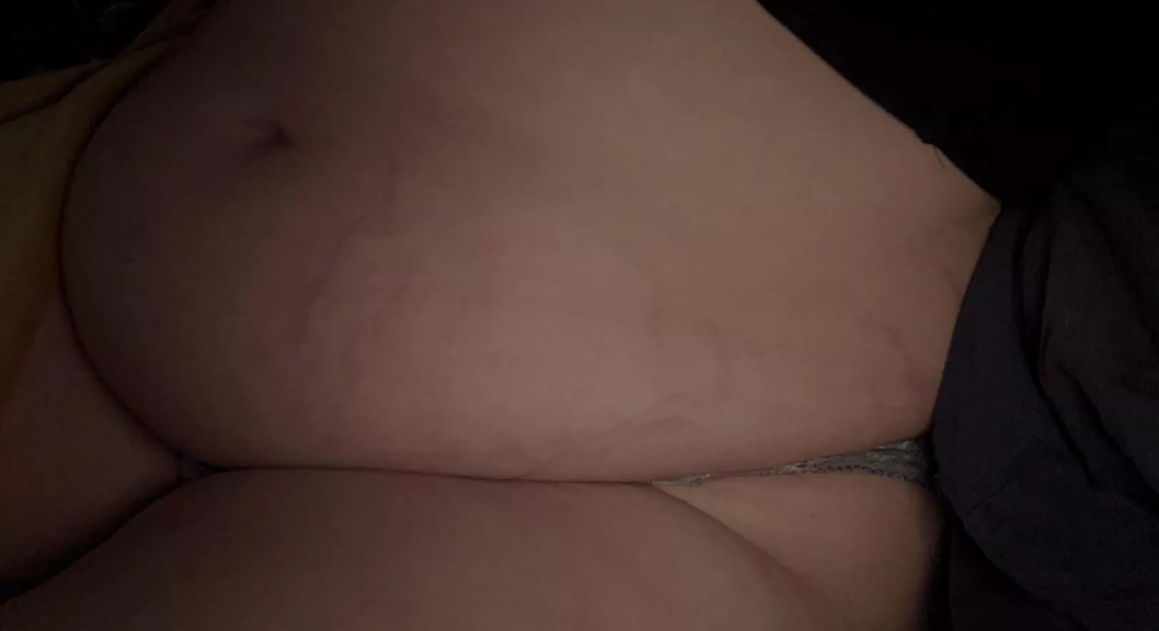 i love my stretch marks 😍 just ordered dominos anyone wanna watch me stuff my face?