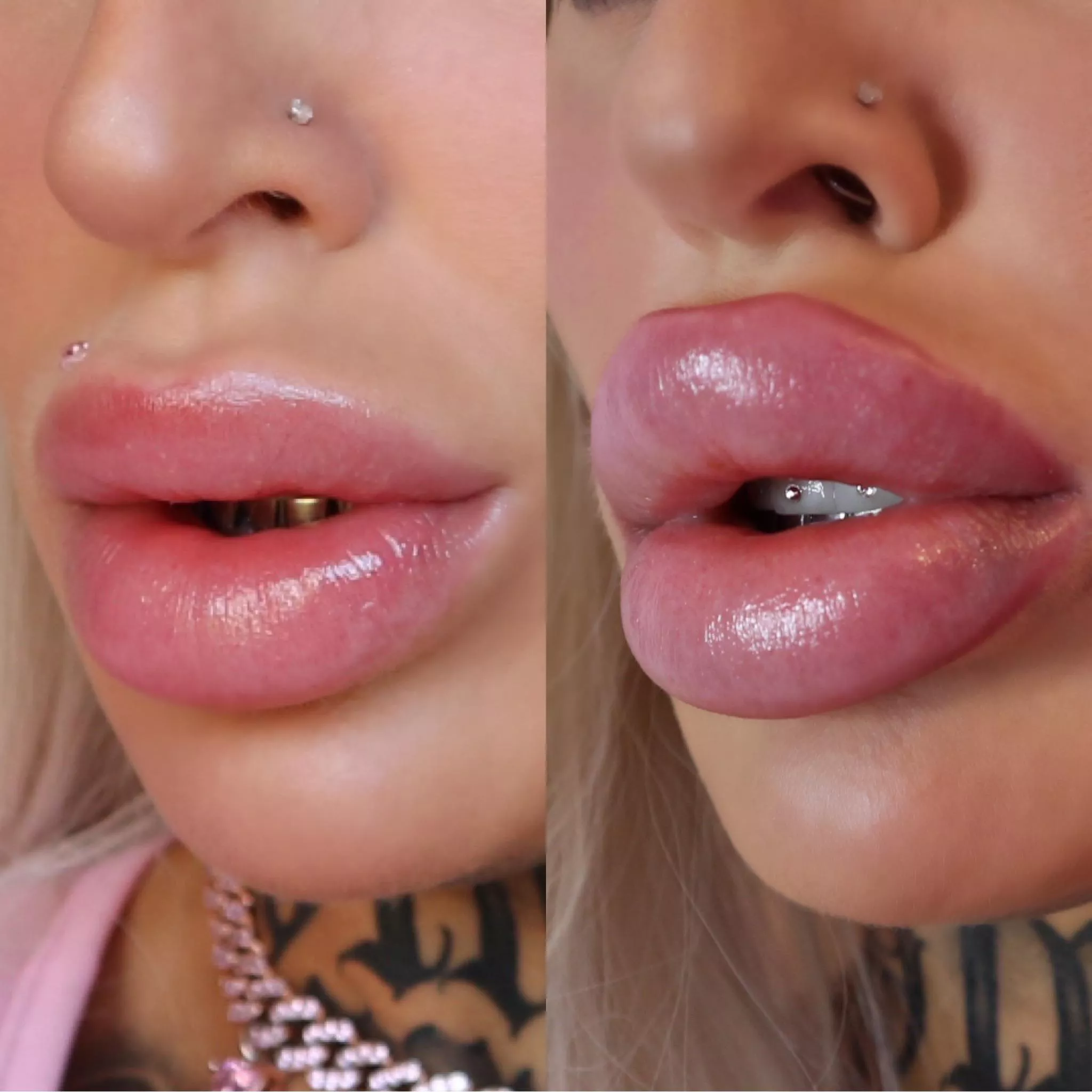 I love transforming into a plastic Bimbo f*ck doll! DSL progress - we did 3ml top up ðŸ’‰ðŸ’•