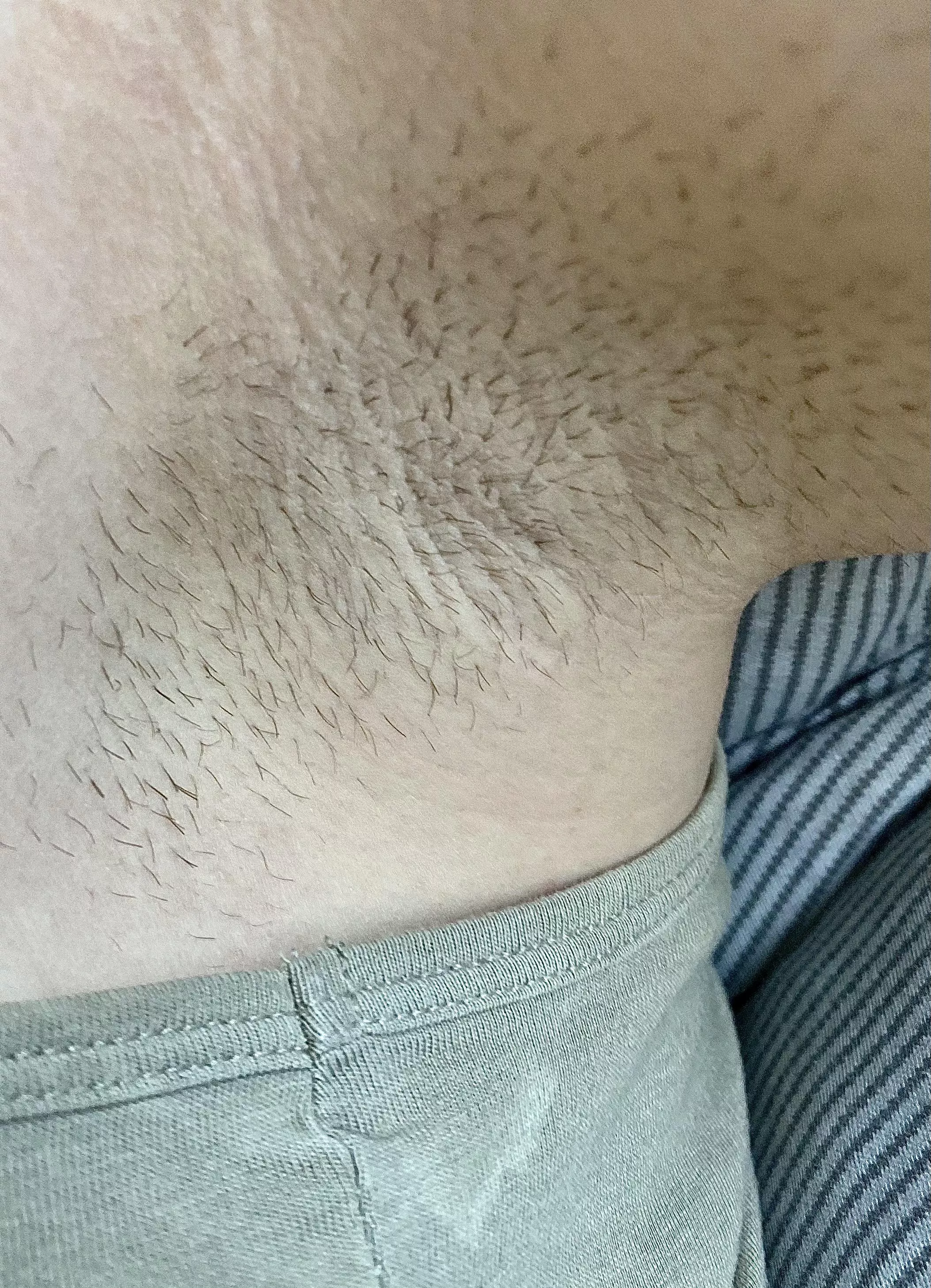 I took a picture of my hairy armpits while I was outside today 🤣 you can see a dried up sweat stain on my top lol