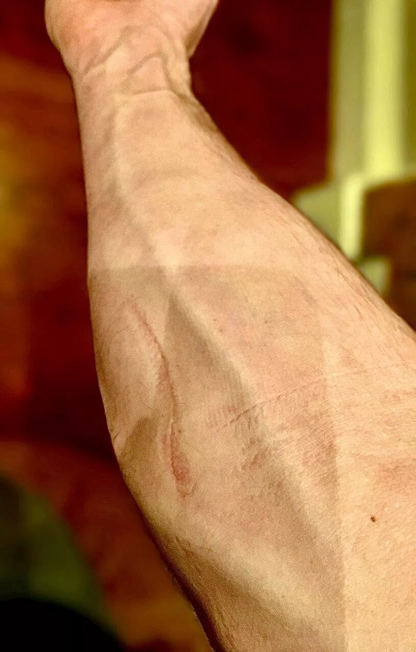 It’s not a scar. Just creases…