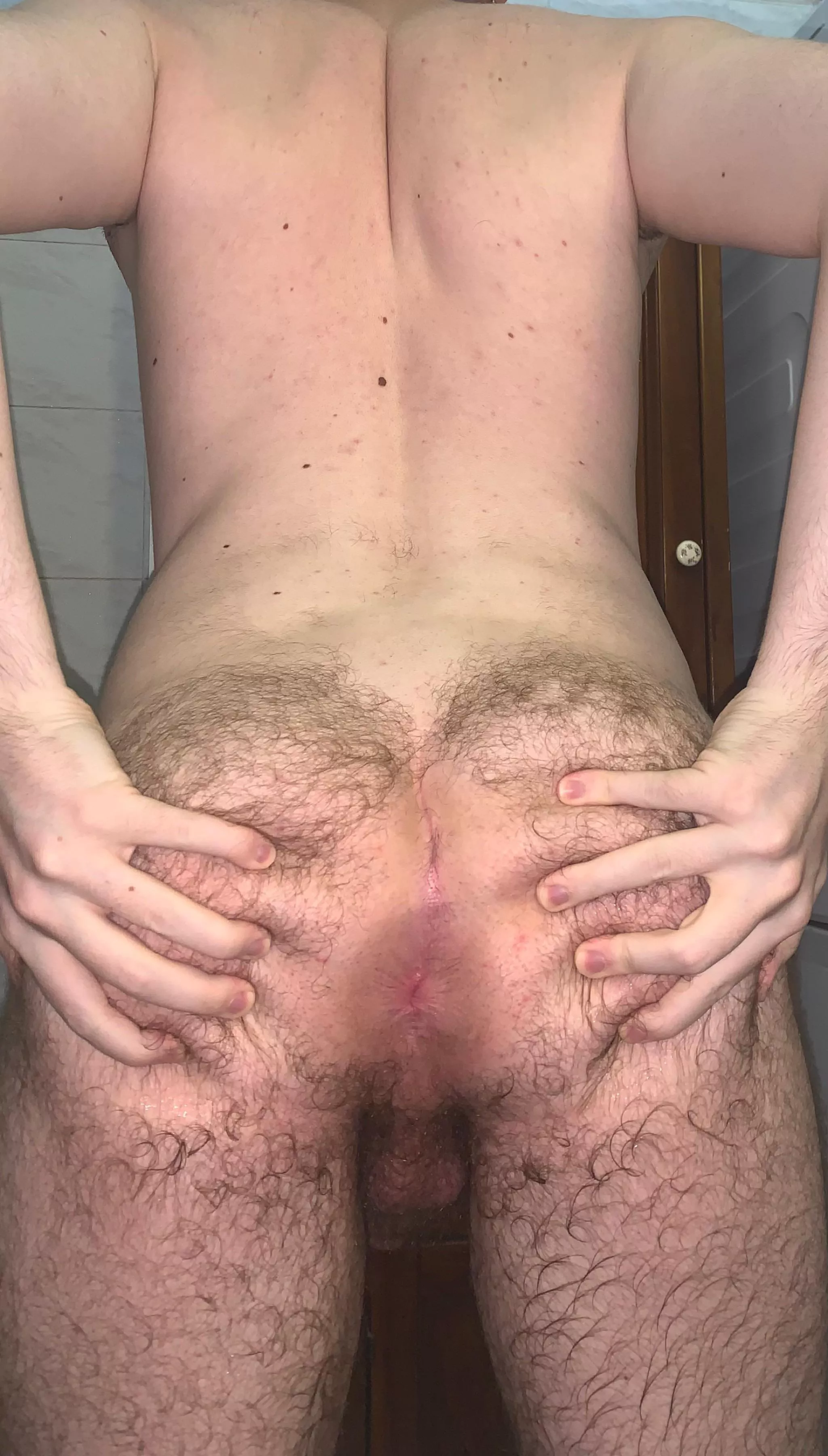 Itâ€™s so tight you hardly see it now :/ DM what you think about it! (20)