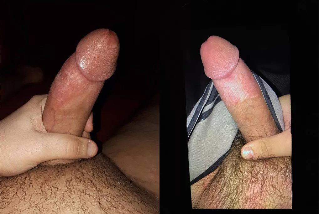 Left or right?