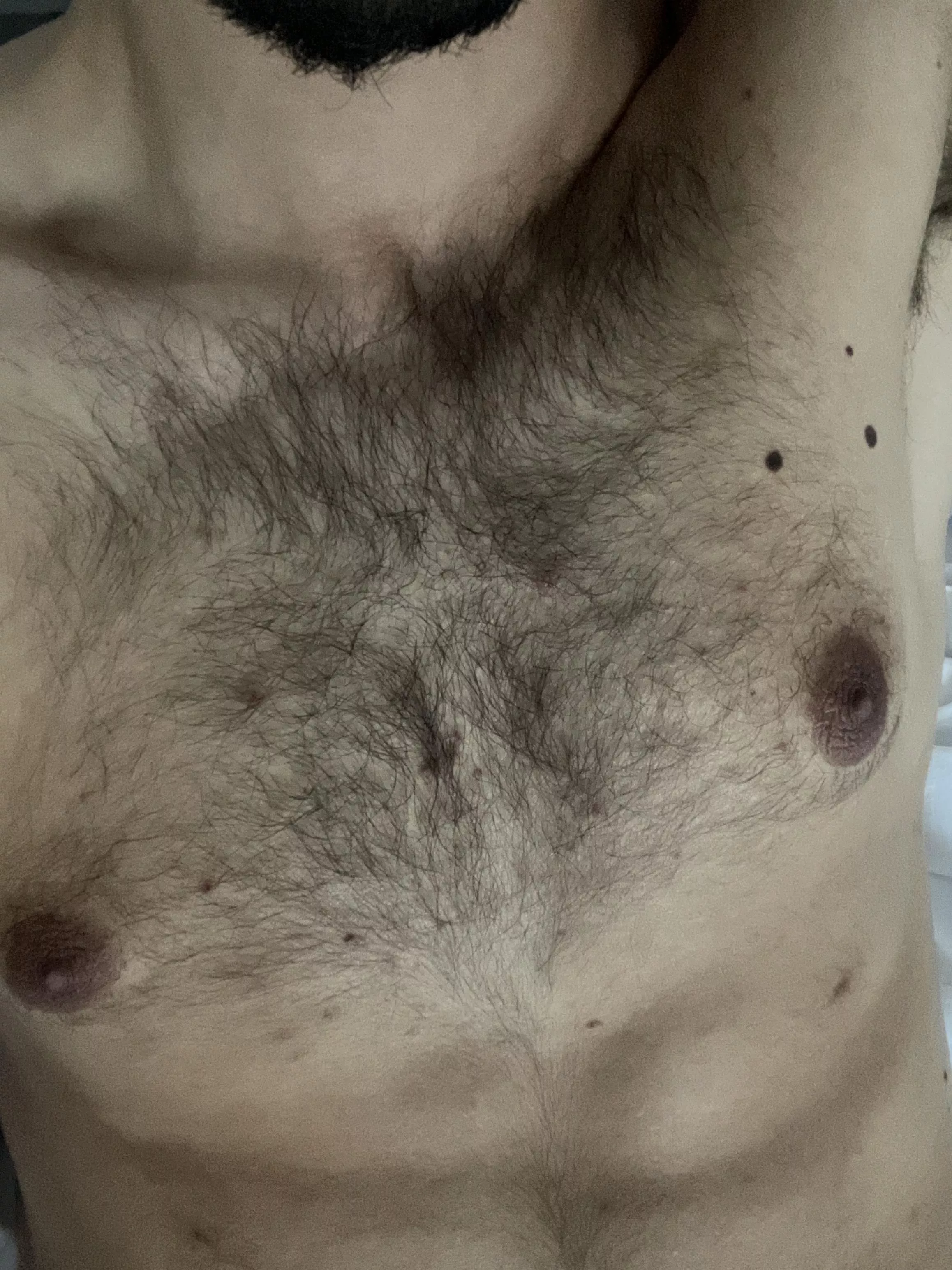 M20 How’s my chest hair? (First post)