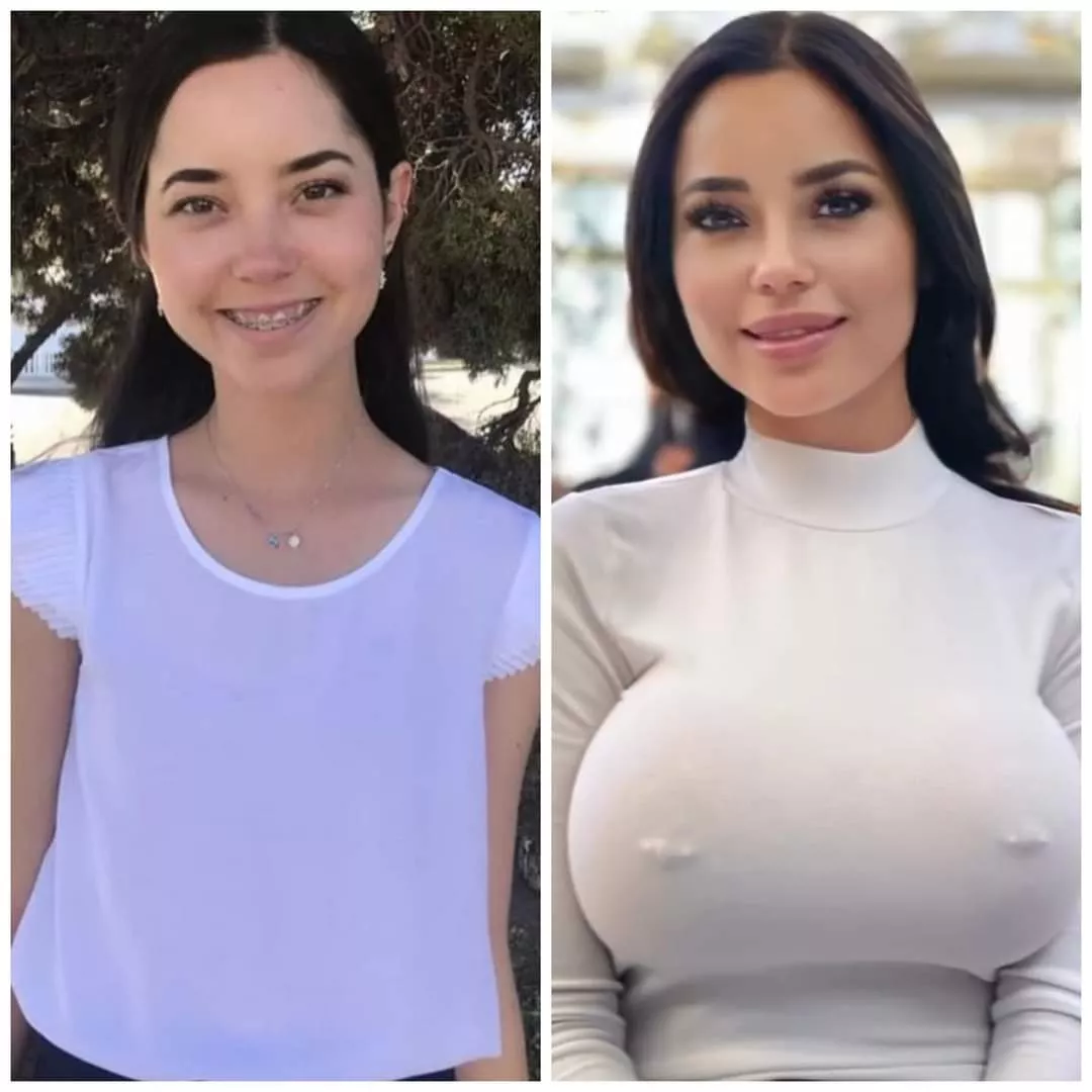 Marisol Yotta Before/After