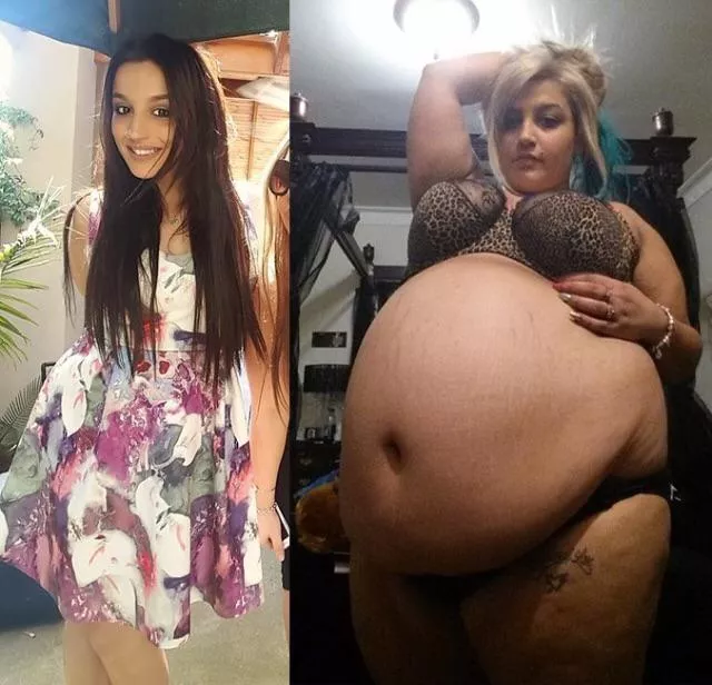 Massive weight gain