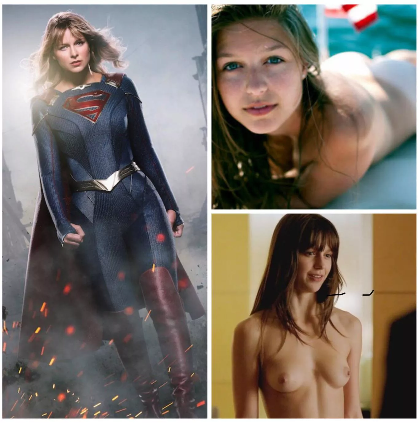 Melissa Benoist