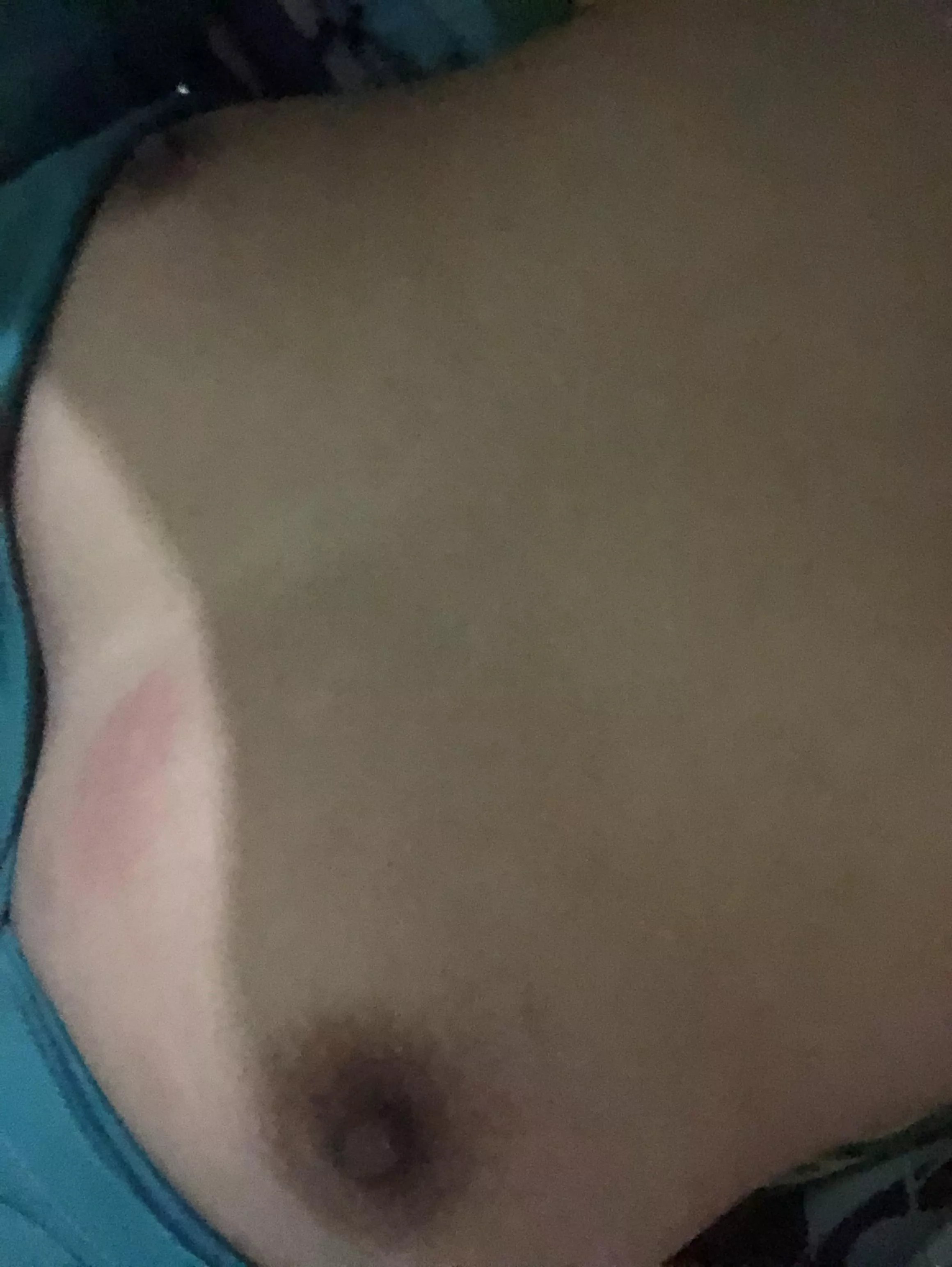 My boob got bitten by an ant