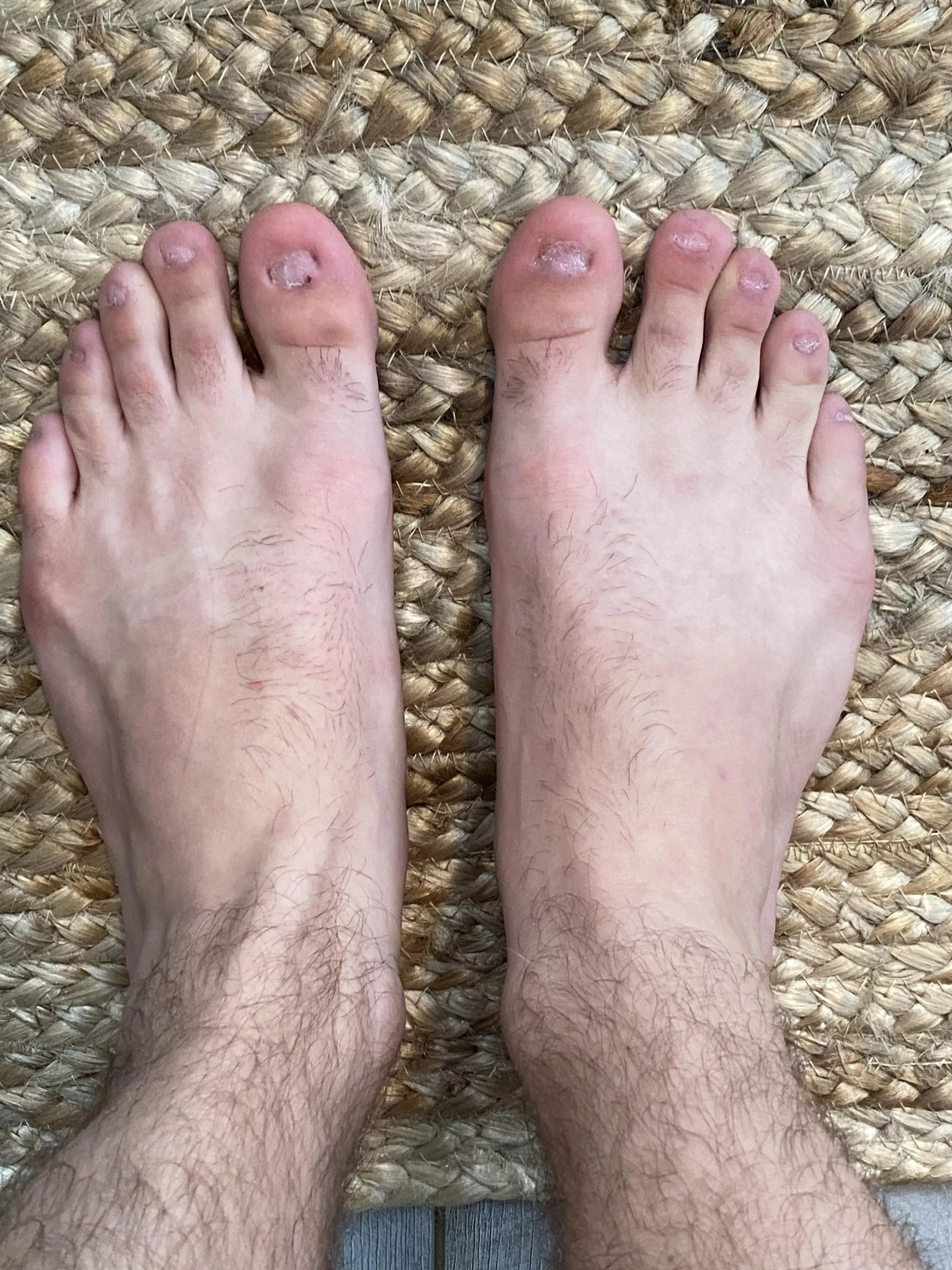 My feet are a little unique, I hope you bros like em🦶