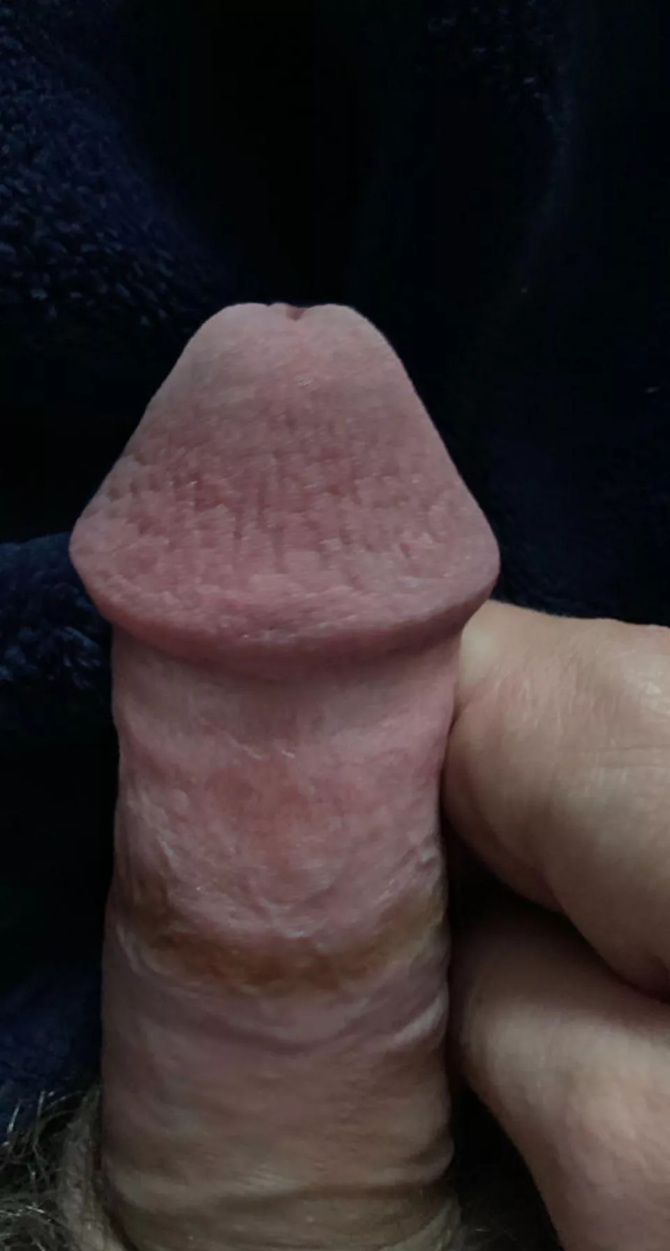 My tiny dick DMs open [18]