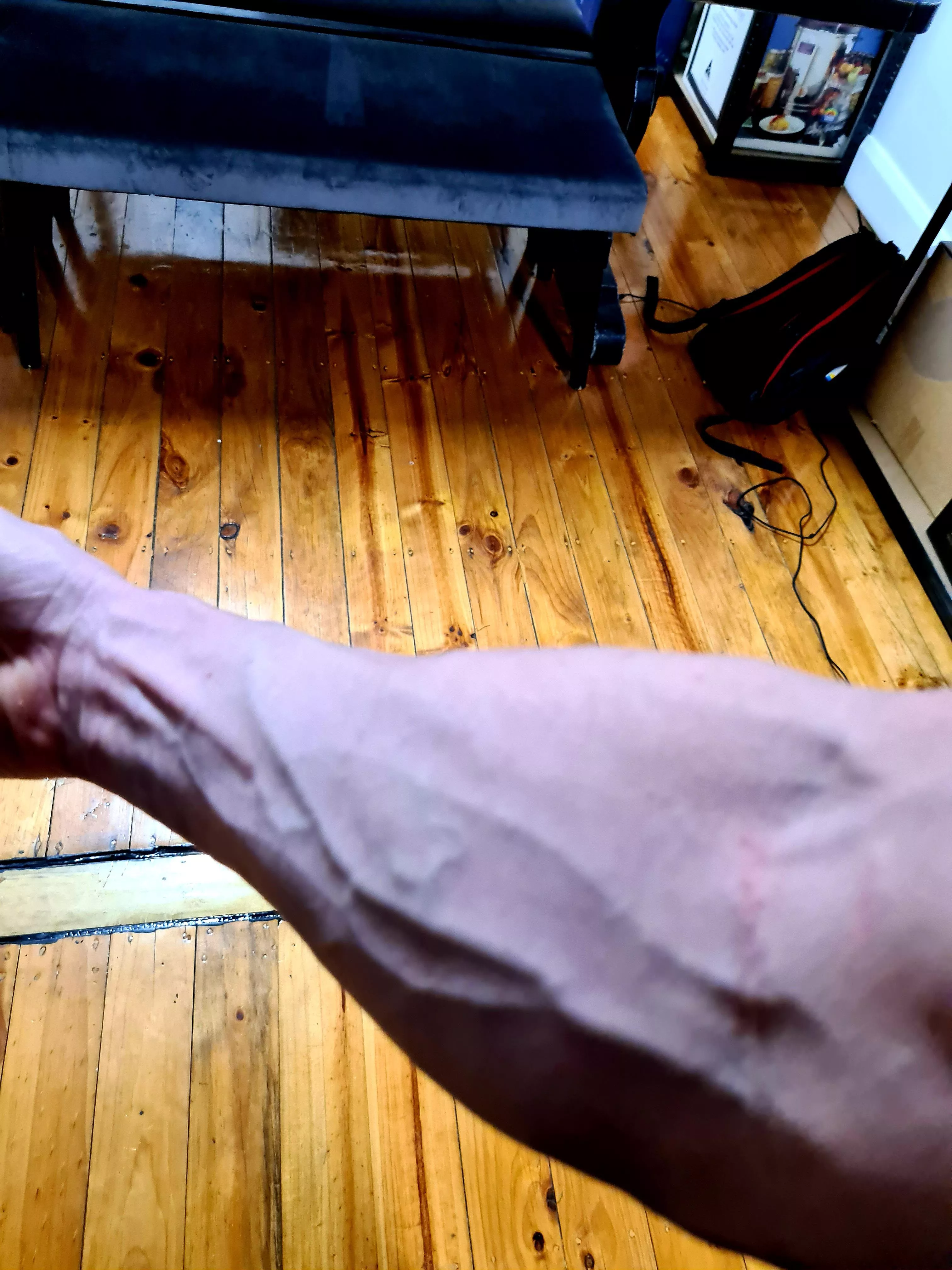 Need more veins.