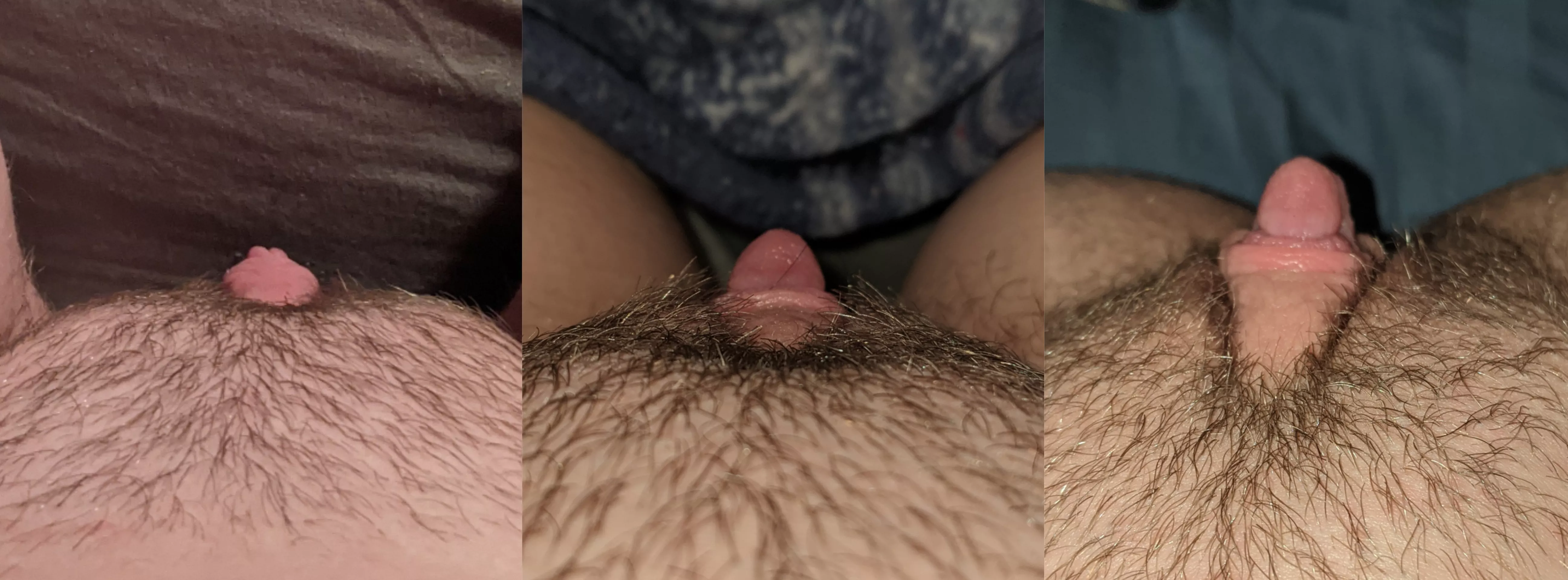 Progression of my clit growth~ 3 weeks on T, first time pumping, and last night after pumping~