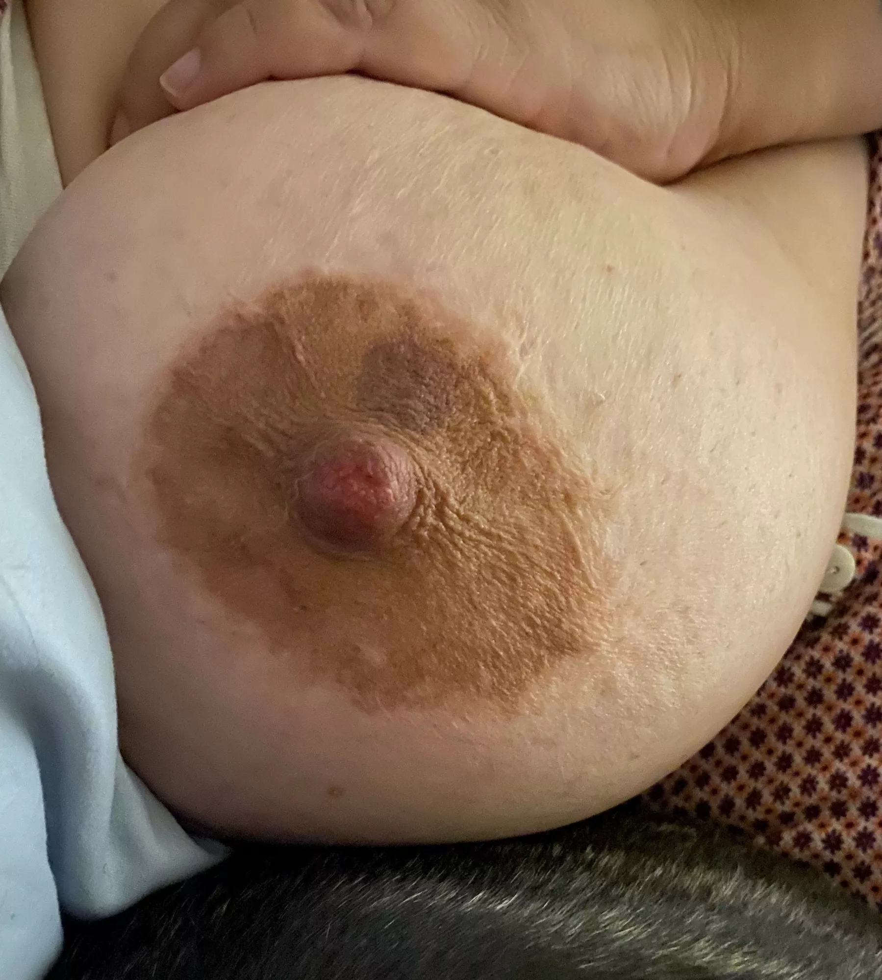 Raw nipple and bruised areolaâ€¦not sure if from my husband or my fuck buddy. Hurt so good.