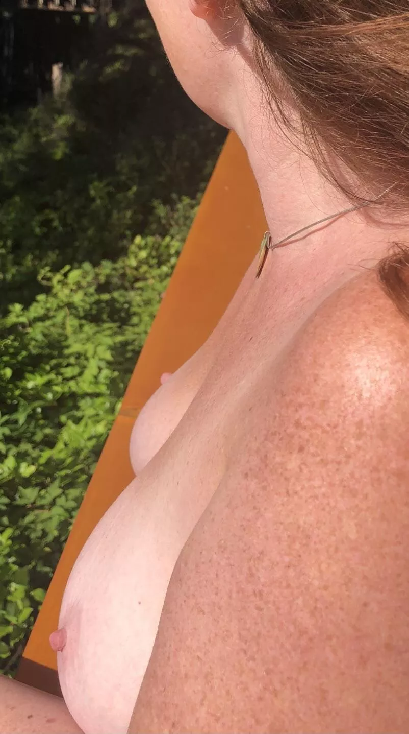 Redhead DD’s freckles in the sun...