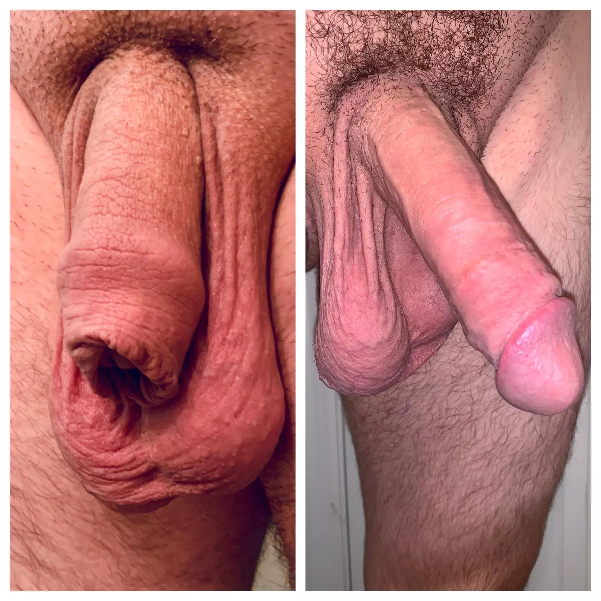 Restored Foreskin here ðŸ‘‹ðŸ» long ways to go still!