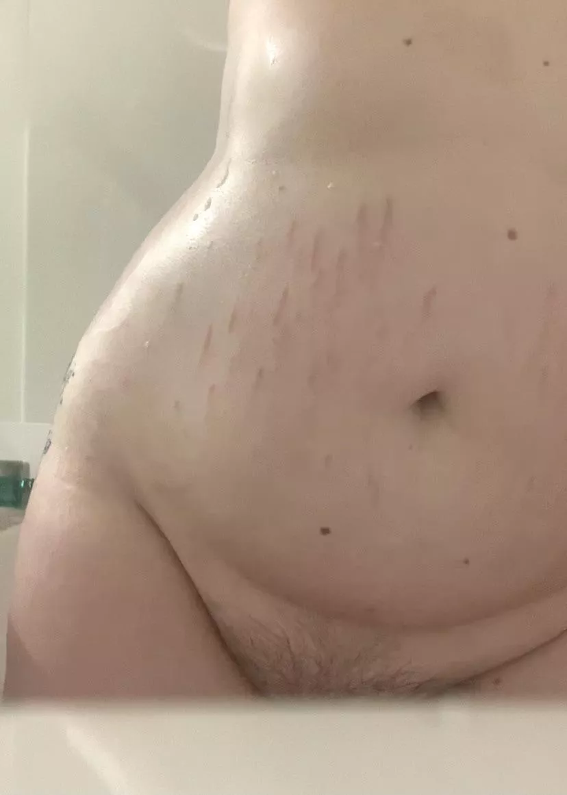 showing off my stretch marks (oc) ðŸ’˜