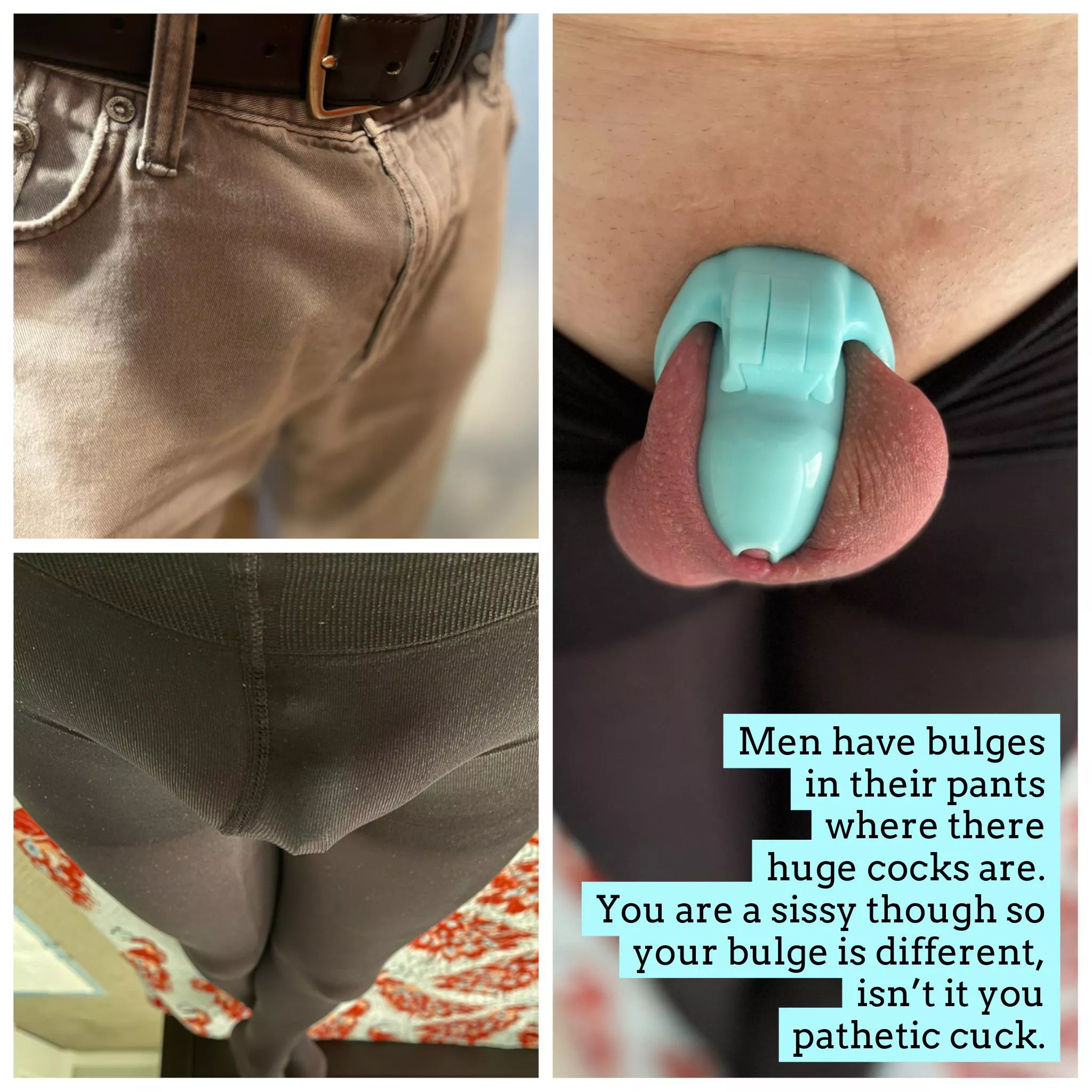 Sissy bulges are differentâ€¦