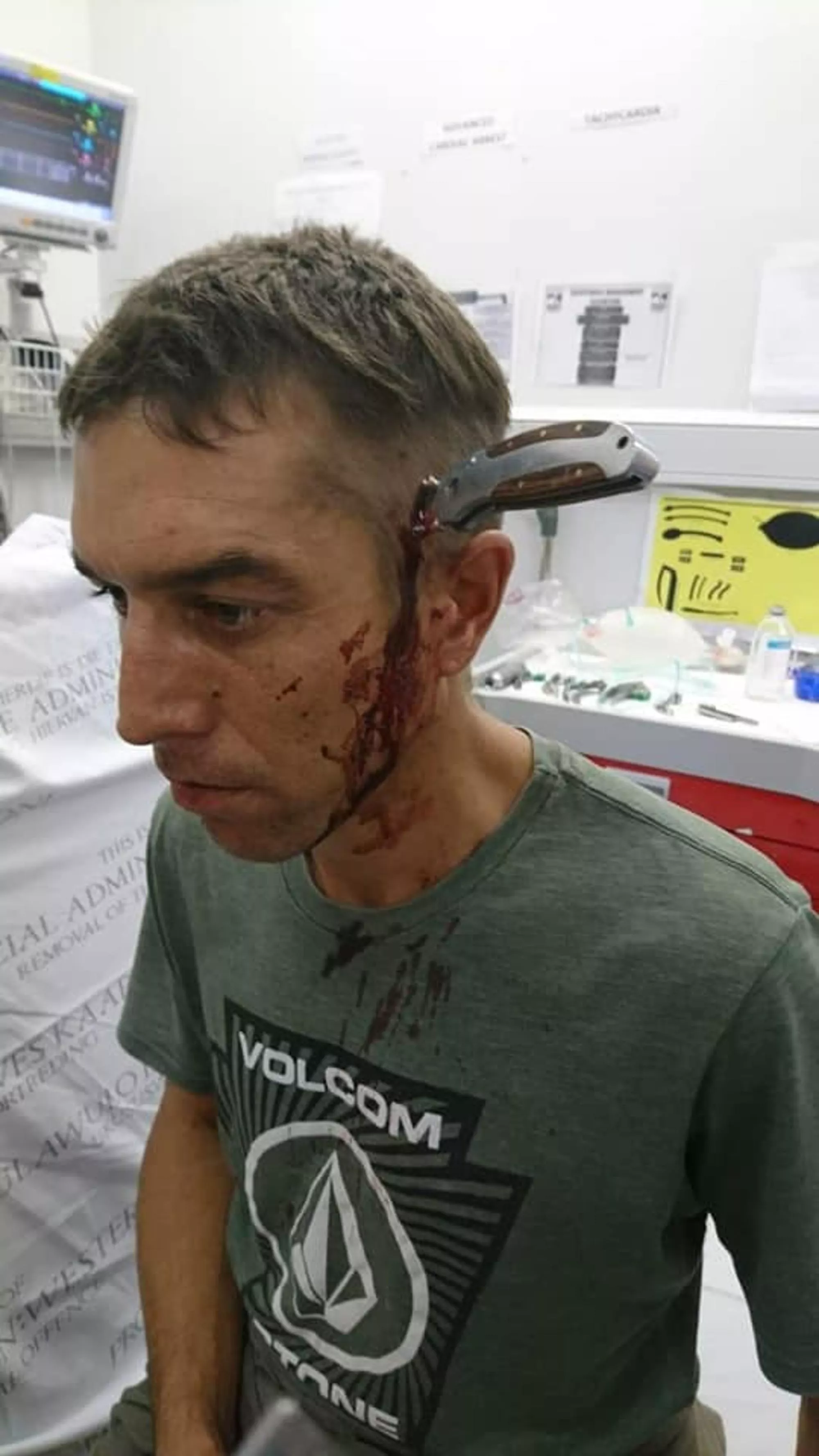 South African cyclist stabbed in head