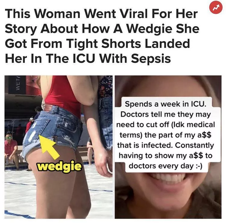 Stay safe with your wedgies out there