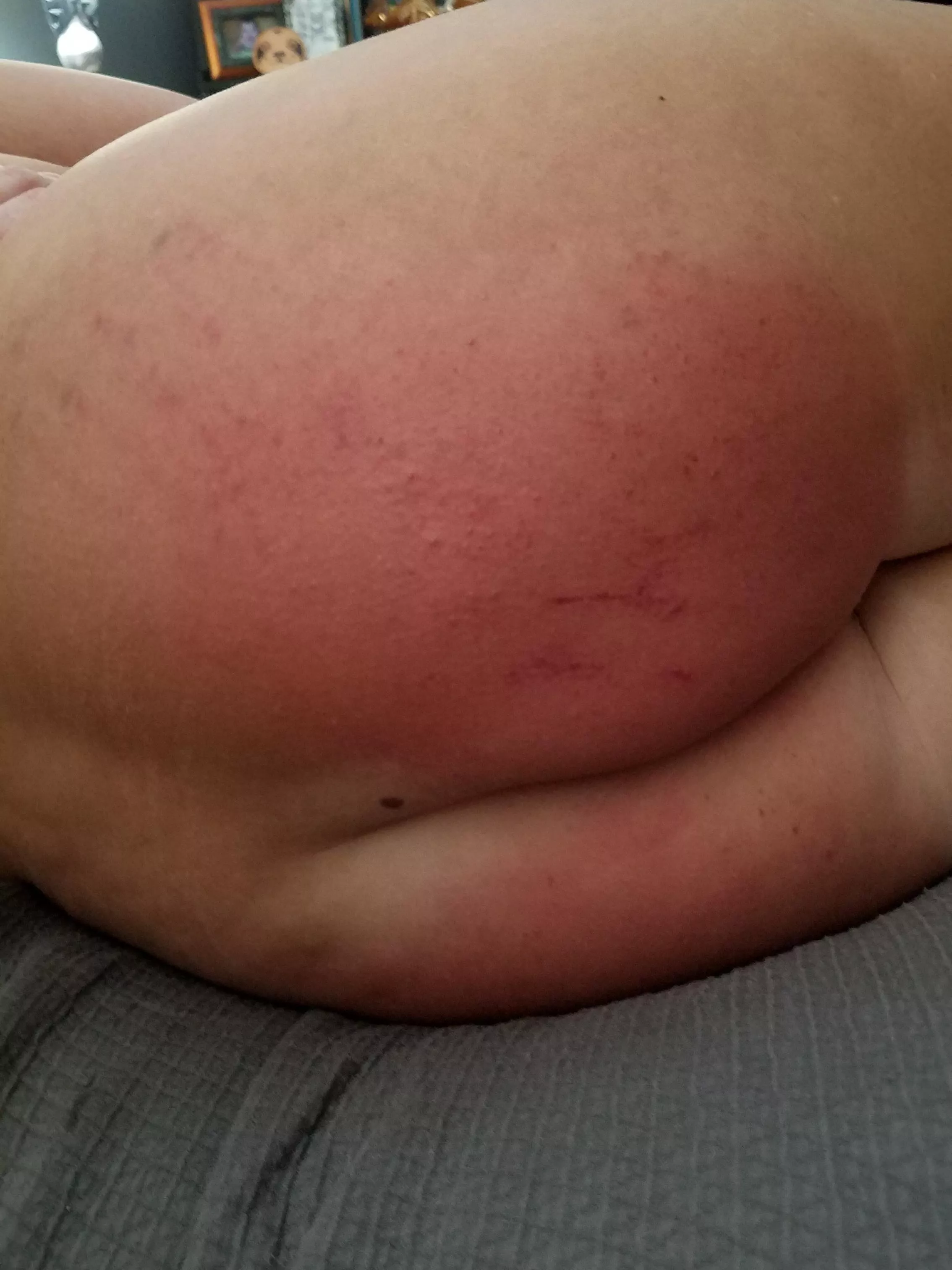 The results of a four handed spanking!