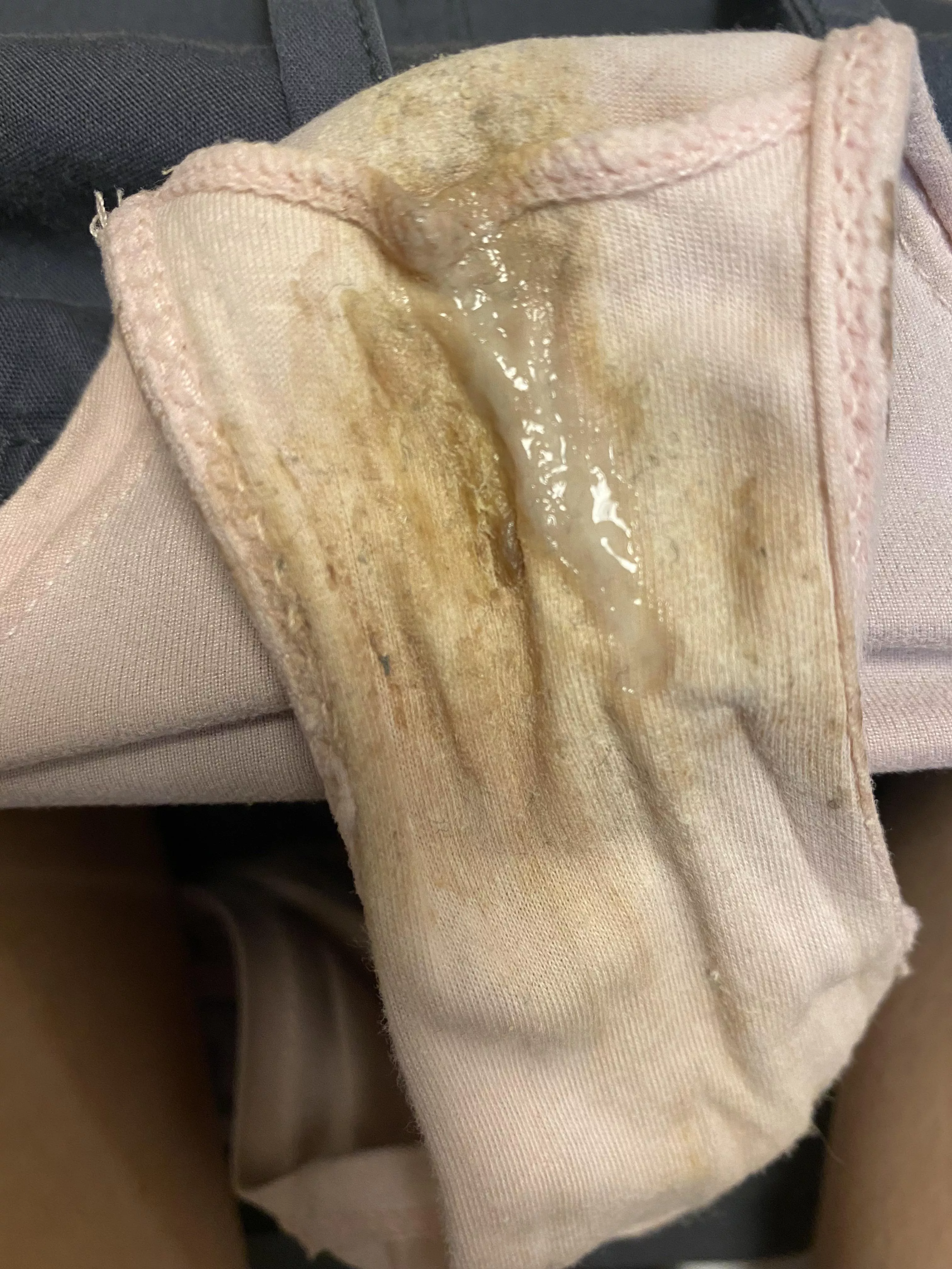 These are filthy 7 day wear 😅 [F]