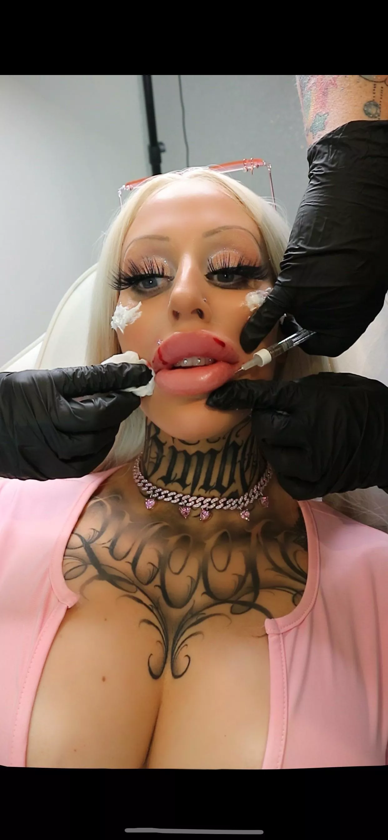 Thinking about dick as Iâ€™m getting injected w more plastic ðŸ’‰ I love being a bimbo fuck doll ðŸ’˜