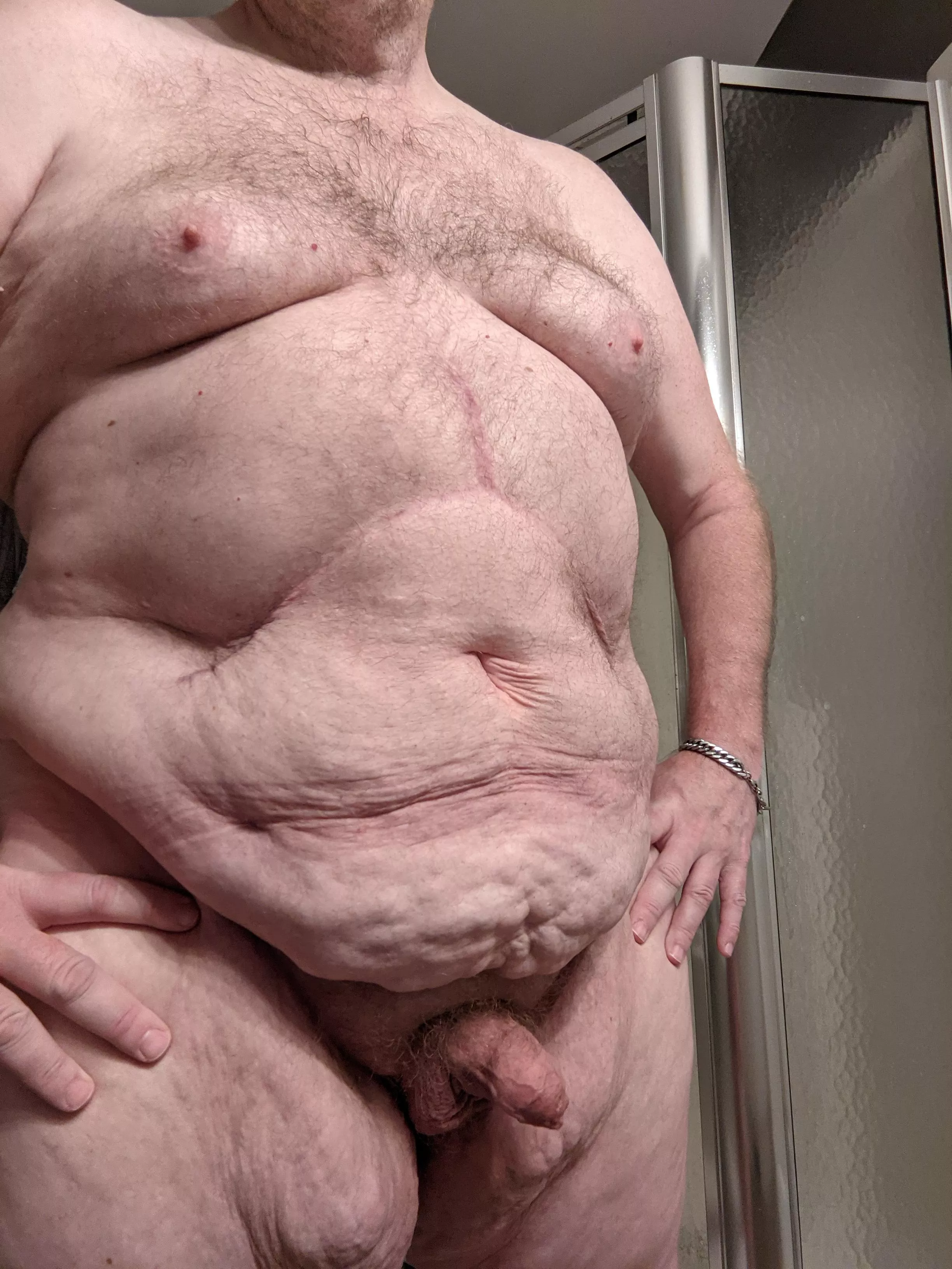 This is my scarred and weathered dad bod. Could use some positivity