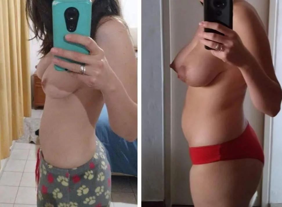 u/pareja-mendocina before and after pregnancy