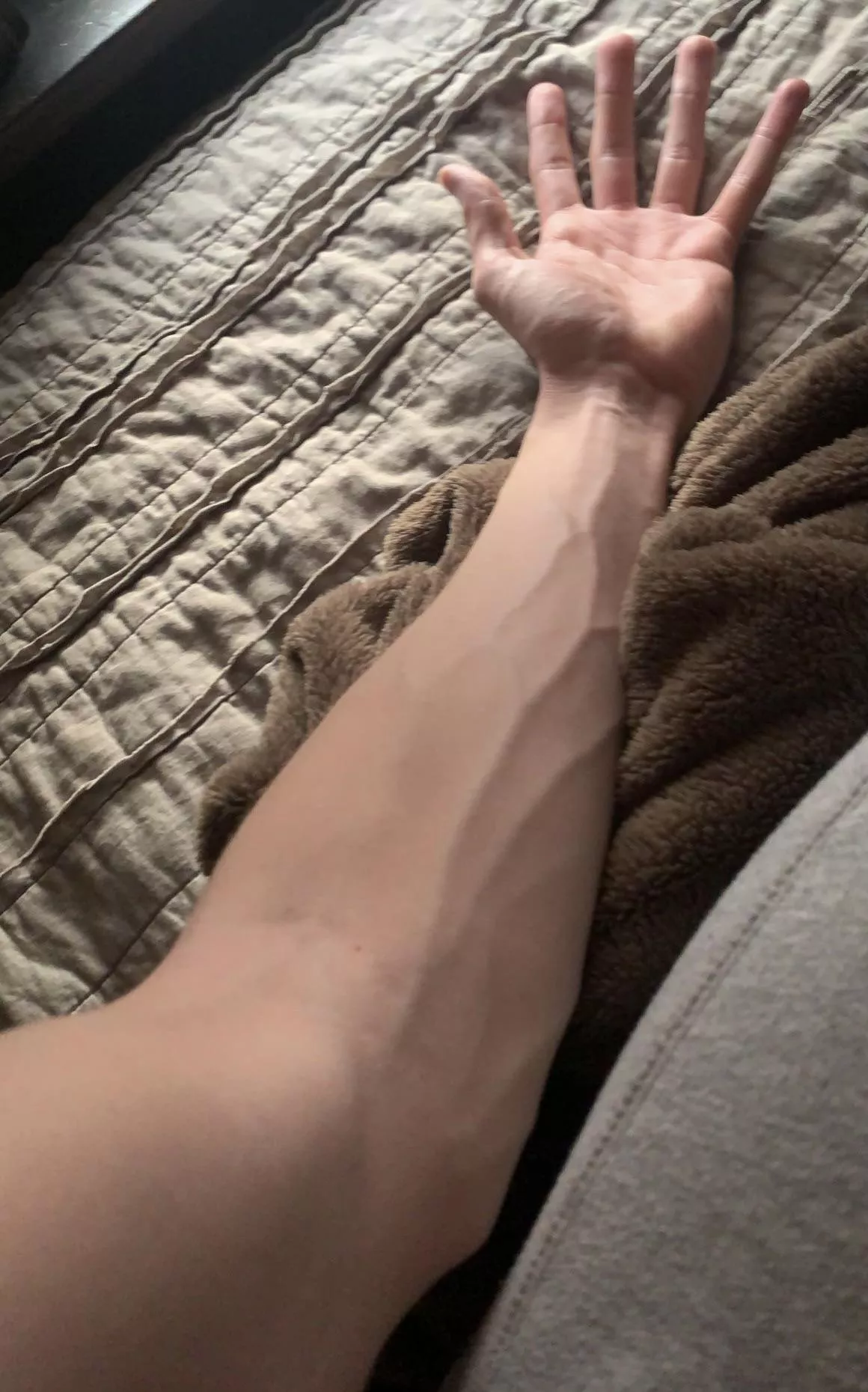 Vein check