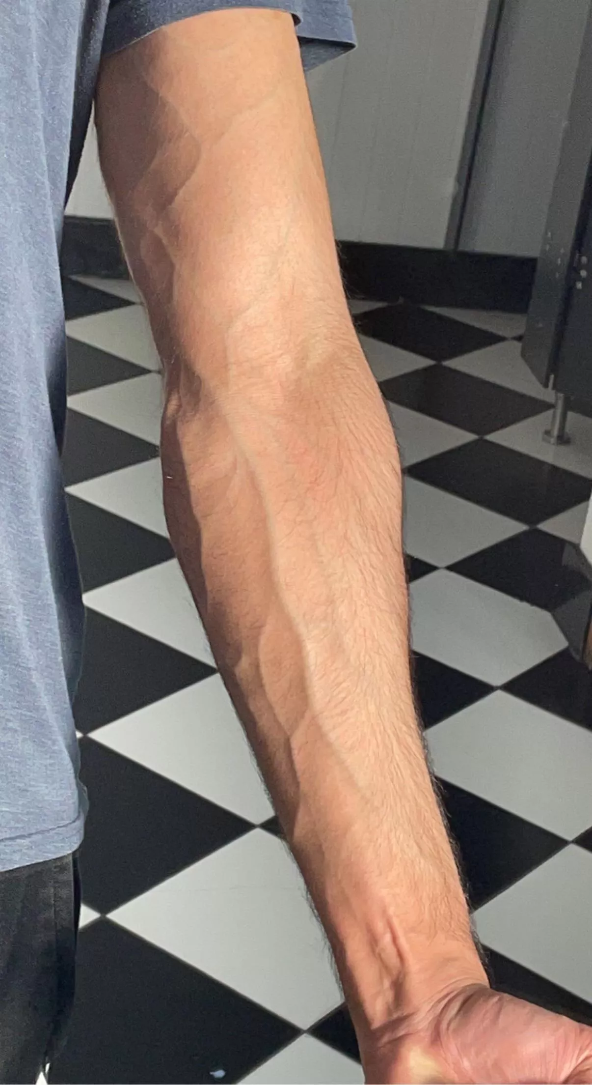 Vein check