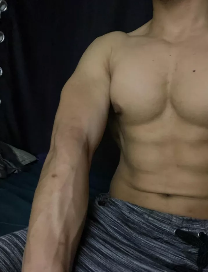 Veins but not much